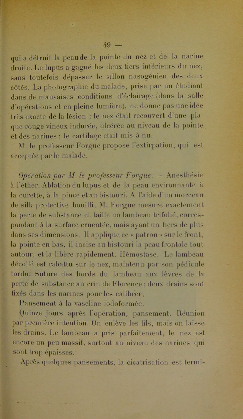 qui a détruit la peau de la pointe du nez et de la narine droite. Le lupus a gagné les deux tiers inférieurs du nez, sans toutefois dépasser le sillon nasogénien des deux côtés. La photographie du malade, prise par un étudiant dans de mauvaises conditions d’éclairage (dans la salle d’opérations et en pleine lumière), ne donne pas une idée très exacte de la lésion : le nez était recouvert d’une pla- que rouge vineux indurée, ulcérée au niveau de la pointe et des narines ; le cartilage était mis à nu. M. le professeur Forgue propose l’extirpation, qui est acceptée parle malade. Opération par M. le professeur Forgue. — Anesthésie à l’éther. Ablation du lupus et de la peau environnante à la curette, à la pince et au bistouri. A l’aide d’un morceau de siIle protective bouilli, M. Forgue mesure exactement la perte de substance et taille un lambeau trifolié, corres- pondant à la surface cruentée, mais ayant un tiers de plus dans ses dimensions. 11 applique ce « patron » sur le front, la pointe en bas, il incise au bistouri la peau frontale tout autour, et la libère rapidement. Hémostase. Le lambeau décollé est rabattu sur le nez, maintenu par son pédicule tordu. Suture des bords du lambeau aux lèvres de la perte de substance au crin de Florence ; deux drains sont fixés dans les narines pour les calibrer. Pansement à la vaseline iodoformée. Quinze jours après l’opération, pansement. Réunion par première intention. On enlève les (ils, mais on laisse les drains. Le lambeau a pris parfaitement, le nez est encore un peu massif, surtout au niveau des narines qui sont trop épaisses. Après quelques pansements, la cicatrisation est termi-