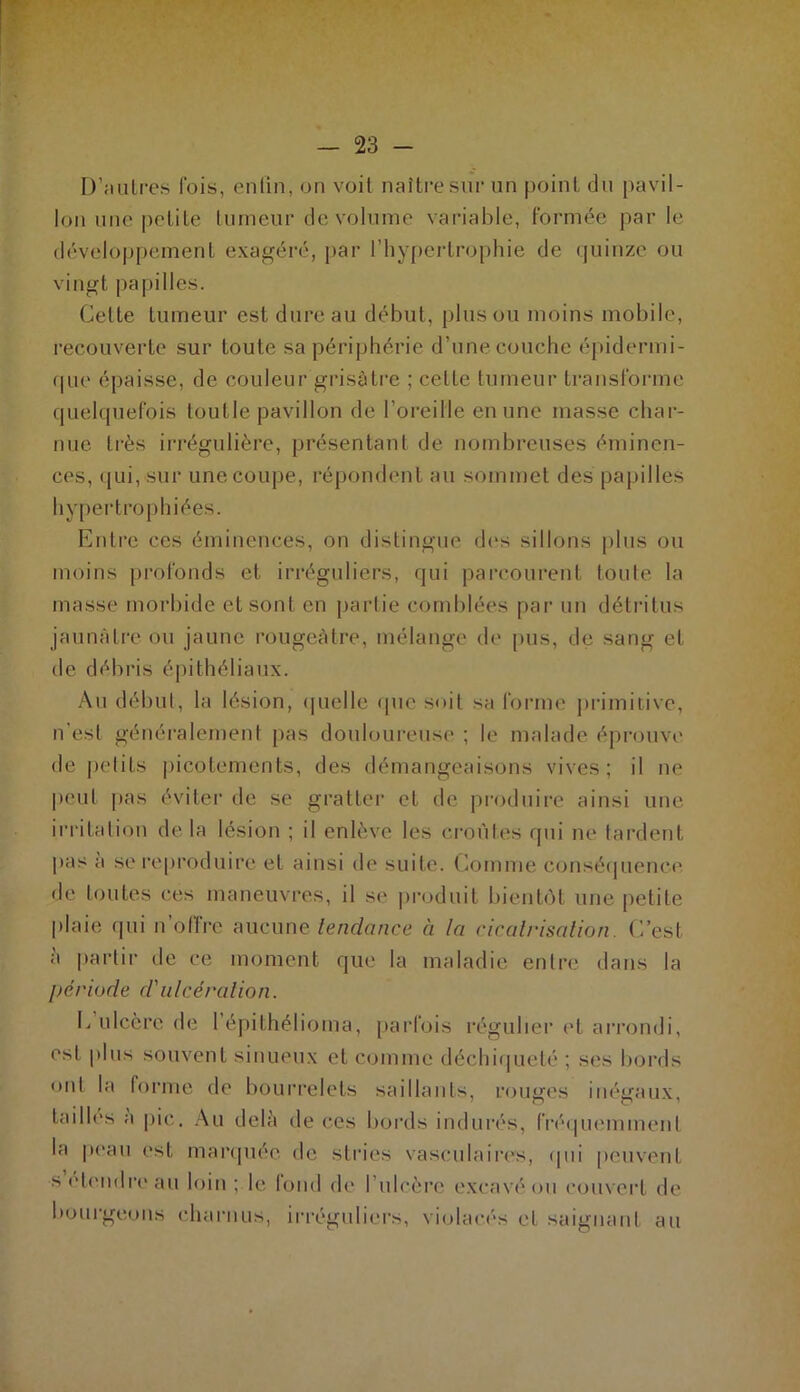 D’autres lois, enfin, on voit naître sur un point du pavil- lon une petite tumeur de volume variable, formée parle développement exagéré, par l’hypertrophie de quinze ou vingt papilles. Cette tumeur est dure au début, plus ou moins mobile, recouverte sur toute sa périphérie d’une couche épidermi- que épaisse, de couleur grisâtre ; cette tumeur transforme quelquefois toutle pavillon de l’oreille en une masse char- nue très irrégulière, présentant de nombreuses éminen- ces, qui, sur une coupe, répondent au sommet des papilles hypertrophiées. Entre ces éminences, on distingue des sillons plus ou moins profonds et irréguliers, qui parcourent toute la masse morbide et sont en partie comblées par un détritus jaunâtre ou jaune rougeâtre, mélange de pus, de sang et de débris épithéliaux. Au début, la lésion, quelle que soit sa forme primitive, n'esl généralement pas douloureuse ; le malade éprouve de petits picotements, des démangeaisons vives; il ne peut pas éviter de se gratter et de produire ainsi une irritation delà lésion ; il enlève les croûtes qui ne tardent pas a se reproduire et ainsi de suite. Comme conséquence, de toutes ces maneuvres, il se produit bientôt une petite plaie qui n oflre aucune tendance à la cicatrisation. C’est à partir de ce moment que la maladie entre dans la période d'ulcération. L ulcère de 1 épithélioma, parfois régulier et arrondi, est plus souvent sinueux et comme déchiqueté ; ses bords oui la forme de bourrelets saillants, rouges inégaux, tailles a pic. Au delà de ces bords indurés, fréquemment la peau est marquée de stries vasculaires, qui peuvent s etendre au loin ; le lond de I ulcère excavé ou couvert de bourgeons charnus, irréguliers, violacés et saignant au