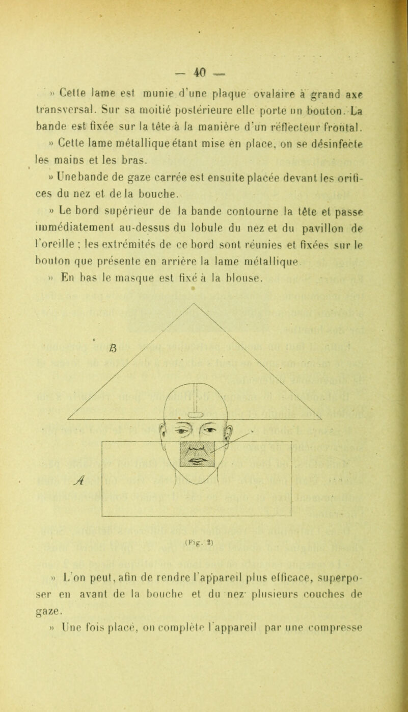 » : T! - 40 » Cetle lame est munie d’une plaque ovalaire a grand axe transversal. Sur sa moitié postérieure elle porte un bouton.-La bande est fixée sur la tête^à la manière d’un rétlècteur frontal. »> Cette lame métallique étant mise en place, on se désinfecte les mains et les bras. M Unebande de gaze carrée est ensuite placée devant les orifi- ces du nez et delà bouche. » Le bord supérieur de la bande contourne la tête et passe immédiatement au-dessus du lobule du nez et du pavillon de l’oreille ; les extrémités de ce bord sont réunies et fixées sur le bouton que présente en arrière la lame métallique. » En bas le masque est fixé à la blouse. ') L’on peut, afin de rendre l’appareil plus efficace, superpo- ser en avant de la bouche et du nez- plusieurs couches de gaze. line fois placé, on complète l'appareil par une compresse »
