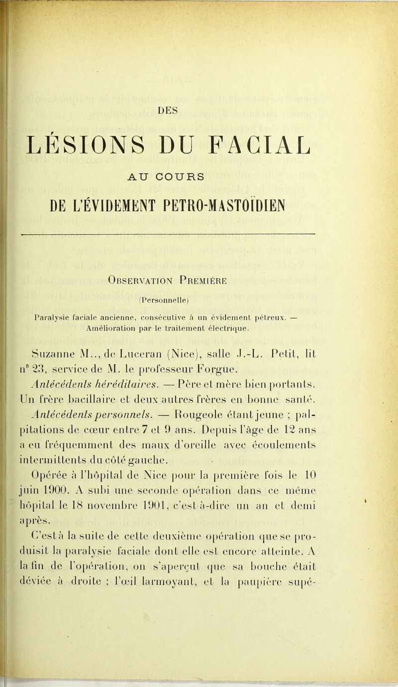 T-rr DES LÉSIONS DU FACIAL AU COURS DE L’ÉVIDEMENT PETRO-MASTOÏDIEN Observation Première (Personnelle) Paralysie faciale ancienne, consécutive à un évidement pétreux. — Amélioration par le traitement électrique. Suzanne M.., de Luceran (Nice), salle J.-L. Petit, lit n” 23, service de M. le professeuf Forgüe. Anlécédenls hérédilaii'cs. — Père et mère bien portants. Un frère bacillaire et deux antres frères en bonne santé. Anlécédenls personnels. — Rougeole étant jeune ; pal- pitations de cœur entre 7 et 9 ans. Depuis l’age de 12 ans a eu fréquemment des maux d’oreille avec écoulements intermittents du côté gauche. Opérée à riiôpital de Nice jiour la jiremière fois le 10 juin 1900. A subi une seconde opération dans ce même hô[)ital le 18 novembre 1901, c’est à-dirc un an et demi après. (7està la suite de cette deuxième ojiération que se jiro- duisit la paralysie faciale dont elle est encore atteinte. A la tin de l’opération, on s’aperçut <pic sa bouche était déviée à droite ; l’œil larmoyant, et la paupière supé-