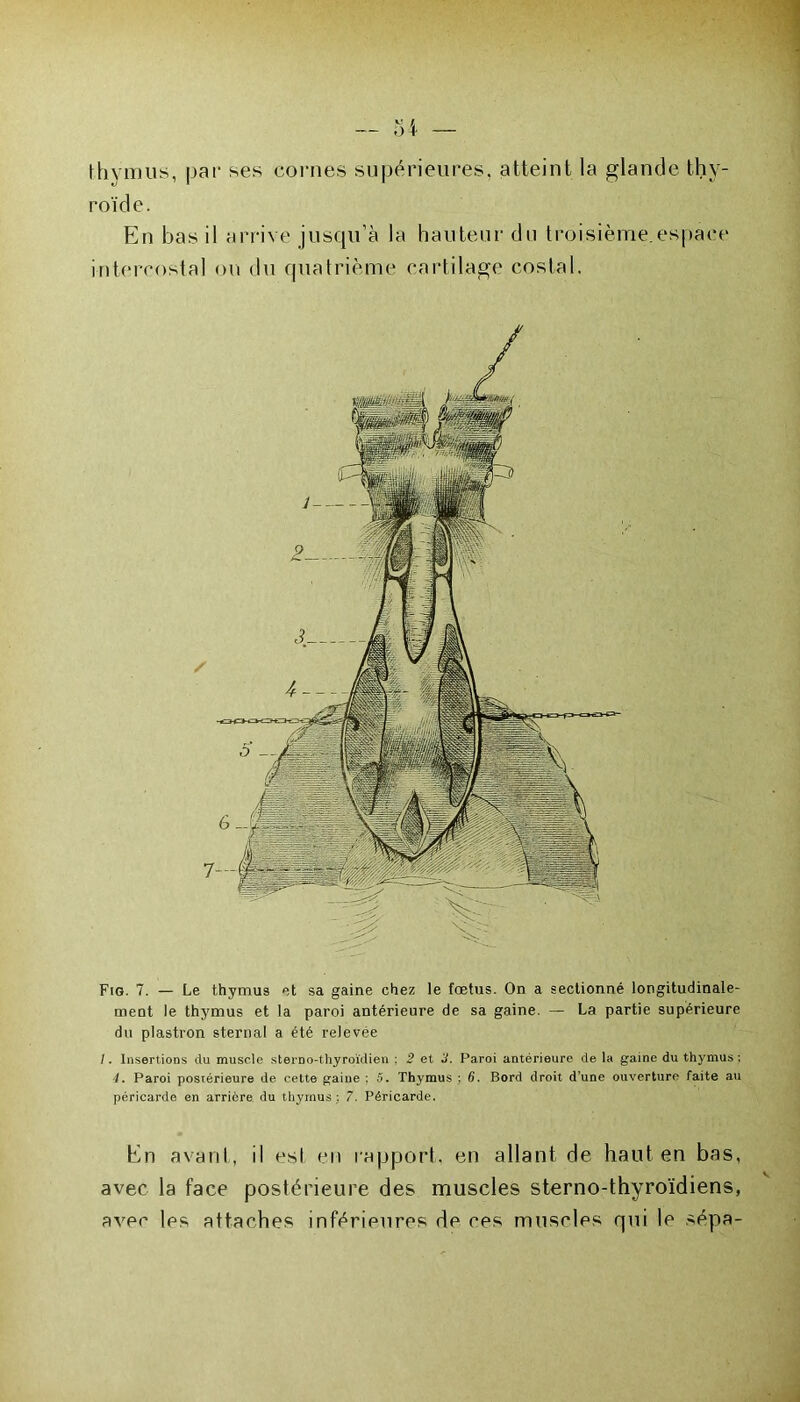 thymus, par ses cornes supérieures, atteint la glande thy- roïde. En bas il arrive jusqu’à la hauteur du troisième.espace intercostal on du quatrième cartilage costal. Fig. 7. — Le thymus et sa gaine chez le fœtus. On a sectionné longitudinale- ment le thymus et la paroi antérieure de sa gaine. — La partie supérieure du plastron sternal a été relevée /. Insertions du muscle sterno-thyroïdien ,2et 2. Paroi antérieure de la gaine du thymus: 4. Paroi postérieure de cette gaine ; 5. Thymus ; 6, Bord droit d’une ouverture faite au péricarde en arrière du thymus ; 7. Péricarde. En avant, il est en rapport, en allant de haut en bas, avec la face postérieure des muscles sterno-thyroïdiens, avec les attaches inférieures de ces muscles qui le sépa-