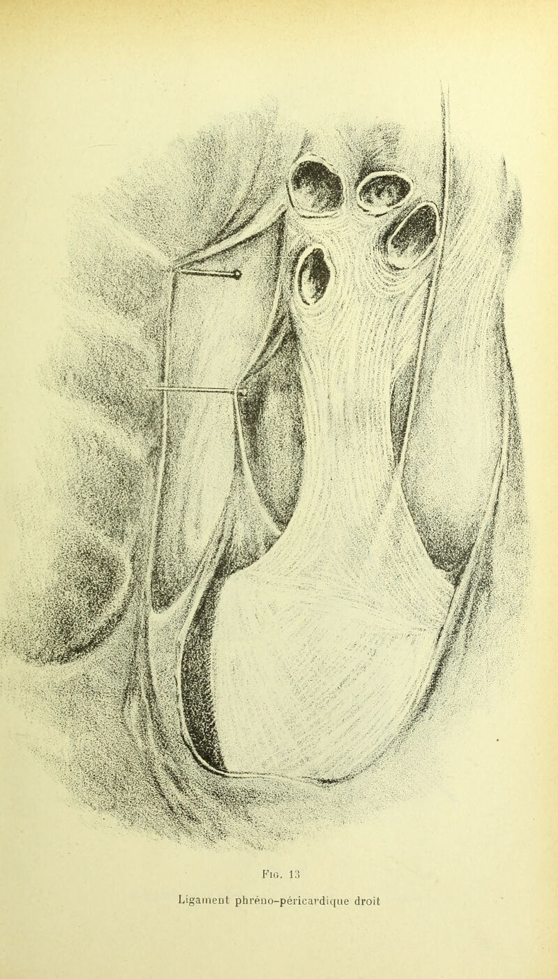 Ligament phréno-péricardique droit