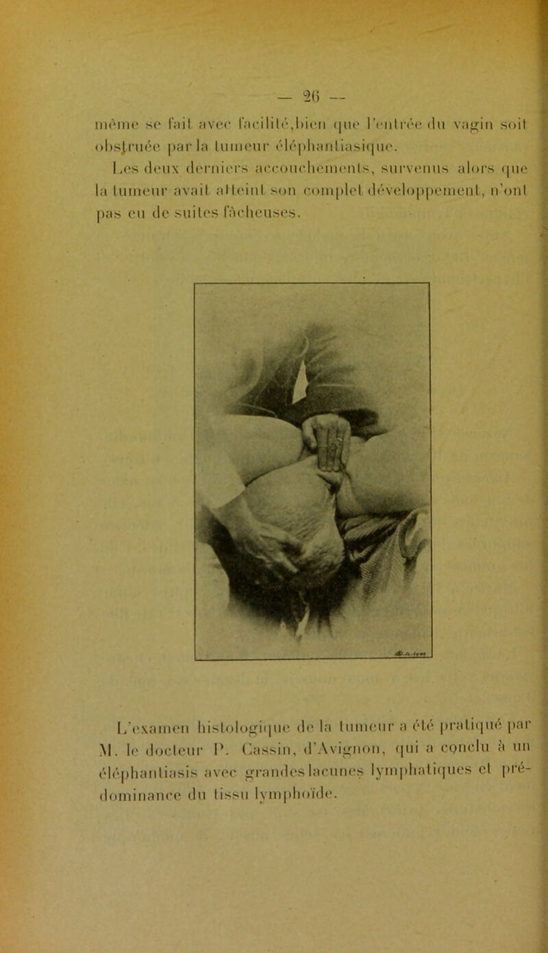 -, iik'miu* s(‘ l’ail avec racilil('‘,l»irii i|iu> l’tMiIrra du vaj^iii soit ()l)sl,riiéc |iarla limuMir (‘l(*|)liatillasi(ni(‘. liCsdcMix (h'rnicrs accoiudu'iiu'iils, survcmis alors que la liimour avait alliMiil son (■.oinplcl dévclo|i|)enienl, n’oiil pas (Ml (le suilos lâcheuses. L't'xameii liislolofjficpie de la luinenr a (de piili(|ii('i par M. le doeleur P. (bassin, d’Avioiioii, (pii a cqmcIu à un ('d(‘|)liaiiliasis avec Grandes lacunes lymplialiques cl pré- dominance du tissu lymphoïde.