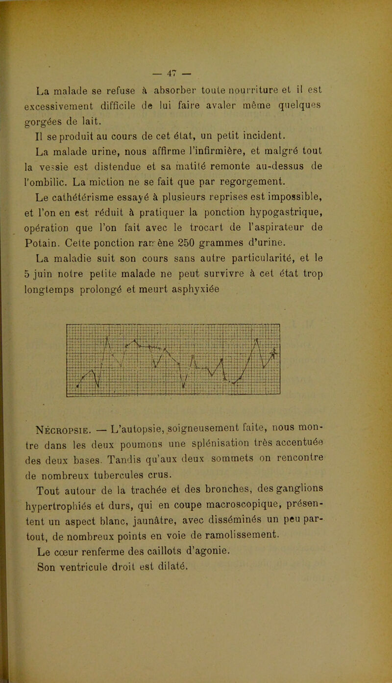La malade se refuse à absorber toute nourriture et il est excessivement difficile de lui faire avaler même quelques gorgées de lait. Il se produit au cours de cet état, un petit incident. La malade urine, nous affirme l’infirmière, et malgré tout la vessie est distendue et sa matité remonte au-dessus de l'ombilic. La miction ne se fait que par regorgement. Le cathétérisme essayé à plusieurs reprises est impossible, et l’on en est réduit à pratiquer la ponction hypogastrique, opération que l’on fait avec le trocart de l’aspirateur de Potain. Cette ponction rarrène 250 grammes d’urine. La maladie suit son cours sans autre particularité, et le 5 juin notre petite malade ne peut survivre à cet état trop longtemps prolongé et meurt asphyxiée Nêcropsie. — L’autopsie, soigneusement faite, nous mon- tre dans les deux poumons une splénisation très accentuée des deux bases. Tandis qu’aux deux sommets on rencontre de nombreux tubercules crus. Tout autour de la trachée et des bronches, des ganglions hypertrophiés et durs, qui en coupe macroscopique, présen- tent un aspect blanc, jaunâtre, avec disséminés un peu par- tout, de nombreux points en voie de ramolissement. Le cœur renferme des caillots d’agonie. Son ventricule droit est dilaté.