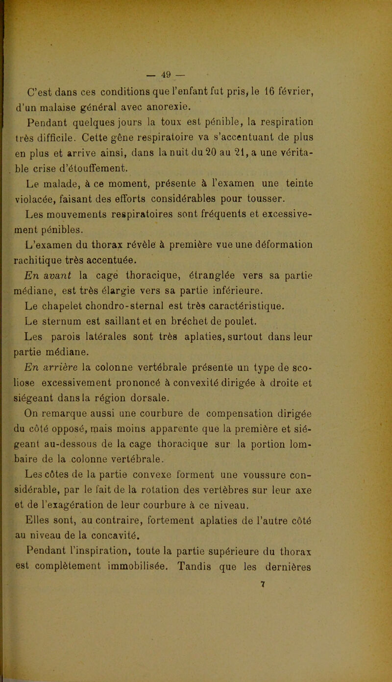 C’est dans ces conditions que l’enfant fut pris, le 16 février, d’un malaise général avec anorexie. Pendant quelques jours la toux est pénible, la respiration très difficile. Cette gêne respiratoire va s’accentuant de plus en plus et arrive ainsi, dans la nuit du 20 au 21, a une vérita- ble crise d’étouflfement. Le malade, à ce moment, présente à l’examen une teinte violacée, faisant des efforts considérables pour tousser. Les mouvements respiratoires sont fréquents et excessive- ment pénibles. L’examen du thorax révèle' à première vue une déformation rachitique très accentuée. En avant la cage thoracique, étranglée vers sa partie médiane, est très élargie vers sa partie inférieure. Le chapelet chondro-sternal est très caractéristique. Le sternum est saillant et en bréchet de poulet. Les parois latérales sont très aplaties, surtout dans leur partie médiane. En arrière la colonne vertébrale présente un type de sco- liose excessivement prononcé à convexité dirigée à droite et siégeant dans la région dorsale. On remarque aussi une courbure de compensation dirigée du côté opposé, mais moins apparente que la première et sié- geant au-dessous de la cage thoracique sur la portion lom- baire de la colonne vertébrale. Les côtes de la partie convexe forment une voussure con- sidérable, par le fait de la rotation des vertèbres sur leur axe et de l’exagération de leur courbure à ce niveau. Elles sont, au contraire, fortement aplaties de l’autre côté au niveau de la concavité. Pendant l’inspiration, toute la partie supérieure du thorax est complètement immobilisée. Tandis que les dernières 7