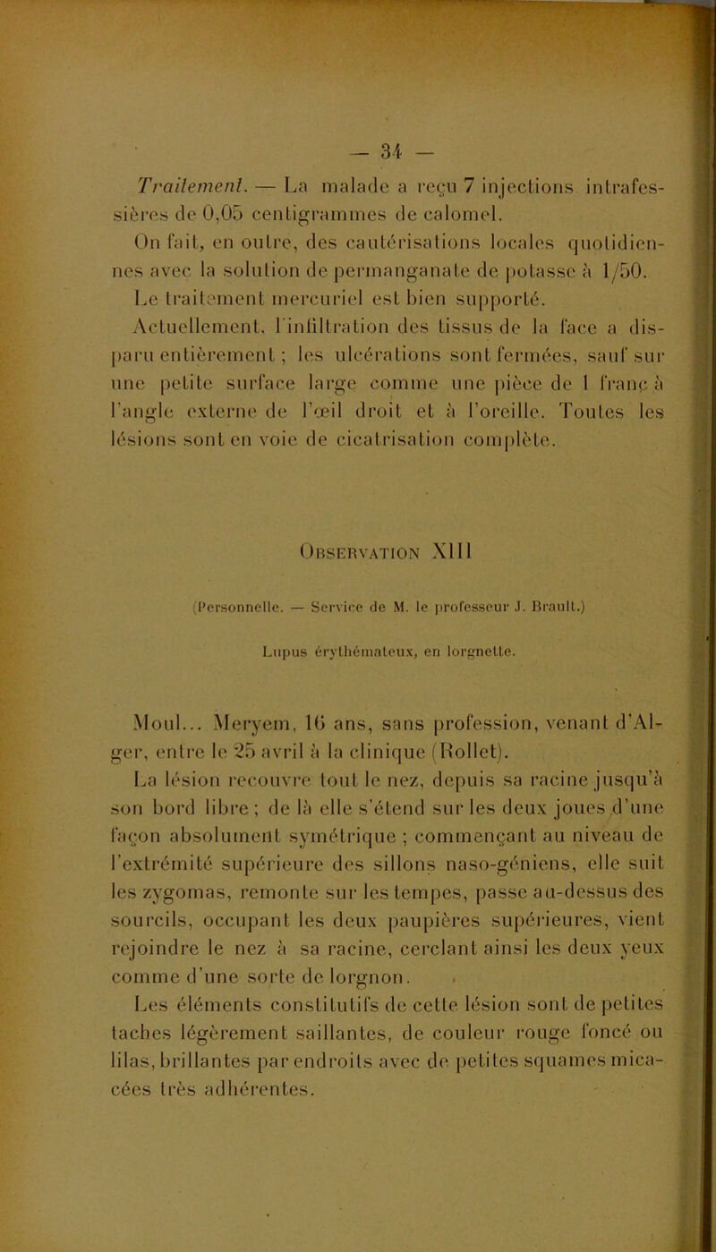 lin — 34 - Trailenient. — La malade a reçu 7 injections intrafes- sières de 0,05 centigrammes de calomel. On fait, en outre, des cautérisalions locales quotidien- nes avec la solution de jDermanganate de i)otasse à 1/50. Le ti*aitement mercuriel est bien supporté. Actuellement, l'inliltratiou des tissus de la face a dis- paru entièrement ; les ulcérations sont fermées, sauf sur une petite surface large comme une |dèce de l franc à l’angle externe de l’œil droit et à l’oreille. Toutes les lésions sont eu voie de cicatrisation complète. ..1 Observation Xlll (l'orsonnelle. — Service de M. le [irofesseur .1. Braull. Lupus érylliémaleux, en lorgnette. S Moul... xMeryem, IG ans, sans profession, venant d’Al- ger, entre le 25 avril à la clinique (Rollet). La lésion recouvre tout le nez, depuis sa racine jusqu’à son bord libre; de là elle s’étend sur les deux joues d’une façon absolument symétrique ; commençant au niveau de l’extrémité supérieure des sillons naso-géniens, elle suit les zygomas, remonte sur les tempes, passe au-dessus des sourcils, occupant les deux paupières supérieures, vient rejoindre le nez à sa racine, cerclant ainsi les deux yeux comme d’une sorte de lorgnon. Les éléments constitutifs de cette lésion sont de petites taches légèrement saillantes, de couleur rouge foncé ou lilas, brillantes par endroits avec de petites squames mica- cées très adhérentes.