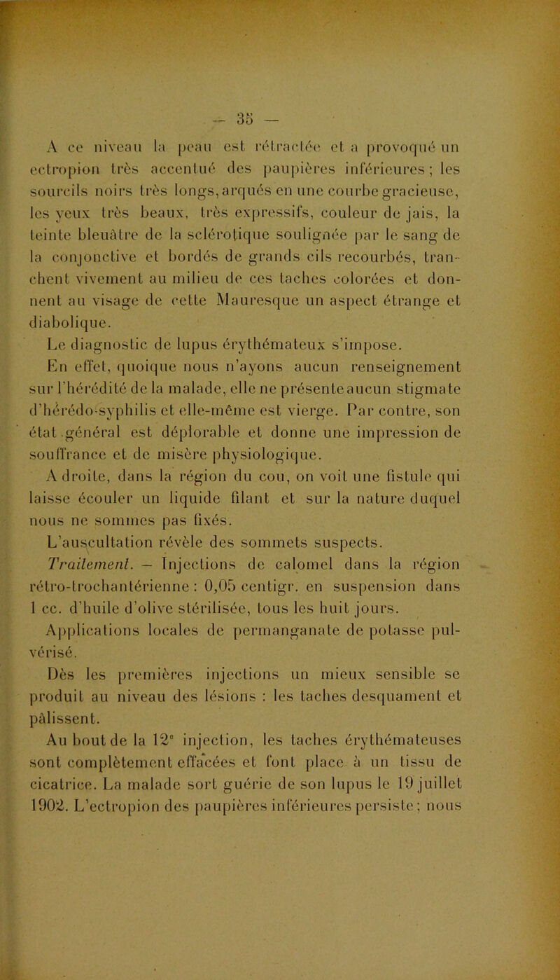 A ce niveau la peau est réti'ac-lée et a provofpié uu ectropiou très accenluè des ])auj)ières inférieures ; les sourcils noirs très longs, arqués en une courbe gracieuse, les yeux très beaux, très expressifs, couleur de jais, la teinte bleuâtre de la sclérotique soulignée par le sang de la conjonctive et bordés de grands cils recourbés, tran- chent vivement au milieu de ces taches colorées et don- nent au visage de cette Mauresque un aspect étrange et diabolique. Le diagnostic de lupus érythémateux s’impose. En effet, quoique nous n’ayons aucun renseignement sur l’hérédité de la malade, elle ne présenteaucun stigmate d’bérédo-syphilis et elle-même est vierge. Par contre, son état .général est déplorable et donne une impression de souffrance et de misère physiologique. Adi'oite, dans la région du cou, on voit une fistule qui laisse écouler un liquide filant et sur la nature duquel nous ne sommes pas fixés. L’auscultation révèle des sommets suspects. Trailemenl. — Injections de calomel dans la région rétro-trochantérienne : 0,05 centigr, en suspension dans 1 cc. d’huile d’olive stérilisée, tous les huit jours. A])plications locales de permanganate de potasse pul- vérisé. Dès les premières injections un mieux sensible se produit au niveau des lésions : les taches desquament et pâlissent. Au bout de la 12° injection, les taches érythémateuses sont complètement effacées et font place à un tissu de cicatrice. La malade soi't guérie de son lupus le 10 juillet 1902. L’cctropion des j)aupières inférieures persiste; nous