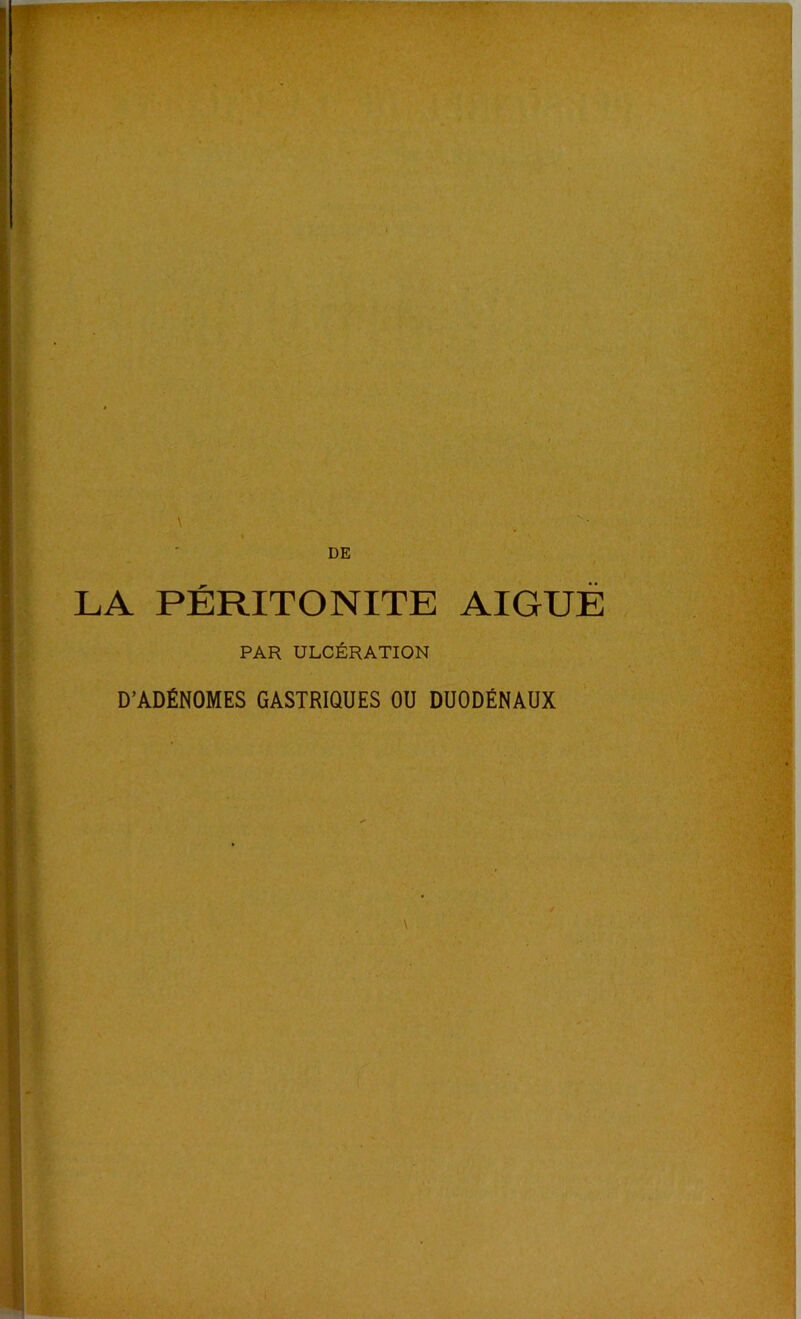 LA PERITONITE AIGUE PAR ULCÉRATION D’ADÉNOMES GASTRIQUES OU DUODÉNAUX