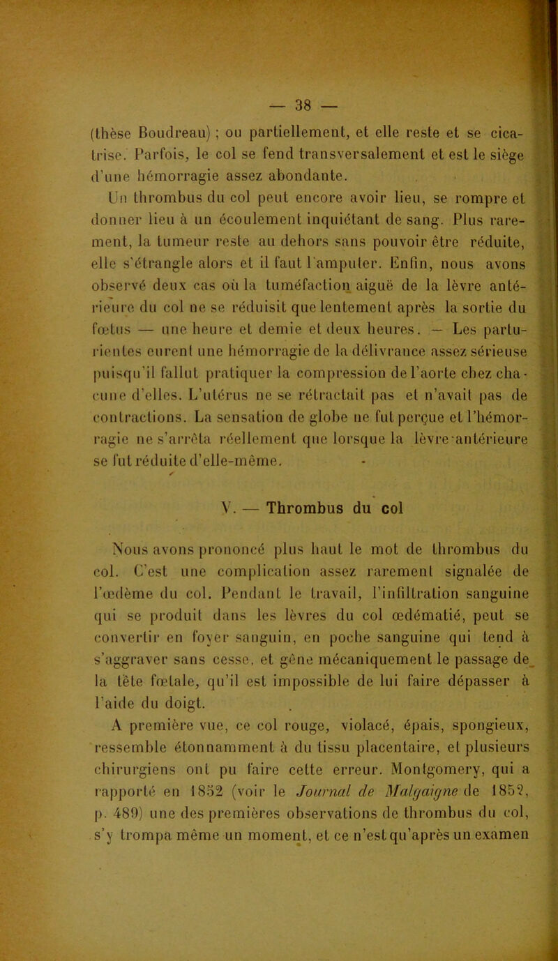 (thèse Boudreau) ; ou partiellement, et elle reste et se cica- ^ trise. Parfois, le col se fend transversalement et est le siège d’une hémorragie assez abondante. ■ Un thrombus du col peut encore avoir lieu, se rompre et donner lieu à un écoulement inquiétant de sang. Plus rare- P ment, la tumeur reste au dehors sans pouvoir être réduite, p elle s'étrangle alors et il faut l'amputer. Enfin, nous avons observé deux cas où la tuméfaction aiguë de la lèvre anté- fî rieure du col ne se réduisit que lentement après la sortie du ^ fœtus — une heure et demie et deux heures. — Les partu- | i-ientes eurent une hémorragie de la délivrance assez sérieuse ^ puisqu’il fallut pratiquer la compression de l’aorte chez cha- cime d’elles. L’utérus ne se rétractait pas et n’avait pas de contractions. La sensation de globe ne fut perçue et l’hémor- ^ ragie ne s’arrêta réellement que lorsque la lèvre’antérieure | se fut réduite d’elle-même, - I V. — Thrombus du coi B Nous avons prononcé plus haut le mot de thrombus du 11 col. C’est une complication assez rarement signalée de ^ l’œdème du col. Pendant le travail, l’infiltration sanguine qui se produit dans les lèvres du col œdématié, peut se f convertir en foyer sanguin, en poche sanguine qui tend à s’aggraver sans cesse, et gêne mécaniquement le passage de_, € la tète fœtale, qu’il est impossible de lui faire dépasser à V; • « ^ l’aide du doigt. . | A première vue, ce col rouge, violacé, épais, spongieux, 5’ ressemble étonnamment à du tissu placentaire, et plusieurs . [• chirurgiens ont pu faire cette erreur. Montgomery, qui a ÿ rapporté en 1852 (voir le Journal de Malgaigne Aq 1852, ^ p. 480) une des premières observations de thrombus du col, ^ s’y trompa même un moment, et ce n’est qu’après un examen
