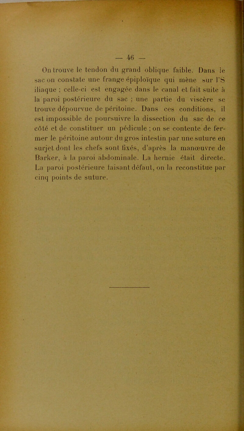 On trouve le tendon du grand oblique faible. Dans le sac on constate une frange épiploïque qui mène sur l’S iliaque ; celle-ci est engagée dans le canal et fait suite h la paroi postérieure du sac ; une partie du viscère se trouve dépourvue de péritoine. Dans ces conditions, il est impossible de poursuivre la dissection du sac de ce côté et de constituer un pédicule ; on se contente de fer- mer le péritoine autour du gros intestin par une suture en surjet dont les chefs sont tixés, d’après la manœuvre de Barker, à la paroi abdominale. La hernie était directe. La paroi postérieure taisant défaut, on la reconstitue par cinq points de suture.