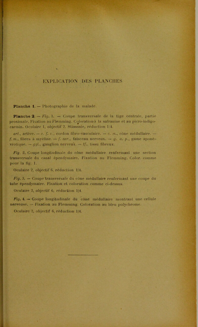 EXPLICATION DES PLANCHES Planche 1. — Photographie de la malade. Planche 2. — Fig, 1. — Coupe transversale de la tige centrale, partie proximale. Fixation auFlemming. Colorationà la safranine et au picro-indig<>- carmin. Oculaire 1, objectif 2. Stiassnic, réduction 1/4. arl., artère. — c. f. u., cordon libro-vasculairc. — c. m., cône médullaire. — f. m., fdjres à myéline. — f. ner., faisceau nerveu.v. — g. a. /)., game aponé- vrotique. — ggl., ganglion nerveux. — If., tissu fibreu.x. Fig. 2. Coupe longitudinale du cône médullaire renfermant une section transver-sale du canal épendymaire. Fixation au Flcmming. Color. comme pour la fig. 1. Oculaire 2, objectif 6, réduction 1|4. Fig. 3. — Coupe transversale du cône médullaire renfermant une coupe du tube épendymaire. Fixation et coloration comme ci-dessus. Oculaire 2, objectif G, réduction 1/4. Fig. 4. — Coupe longitudinale du cône médullaire montrant une cellule nerveuse. — Fixation au Flemrning. Coloration au bleu polychrome. Oculaire 2, objectif 6, réduction 1(4.