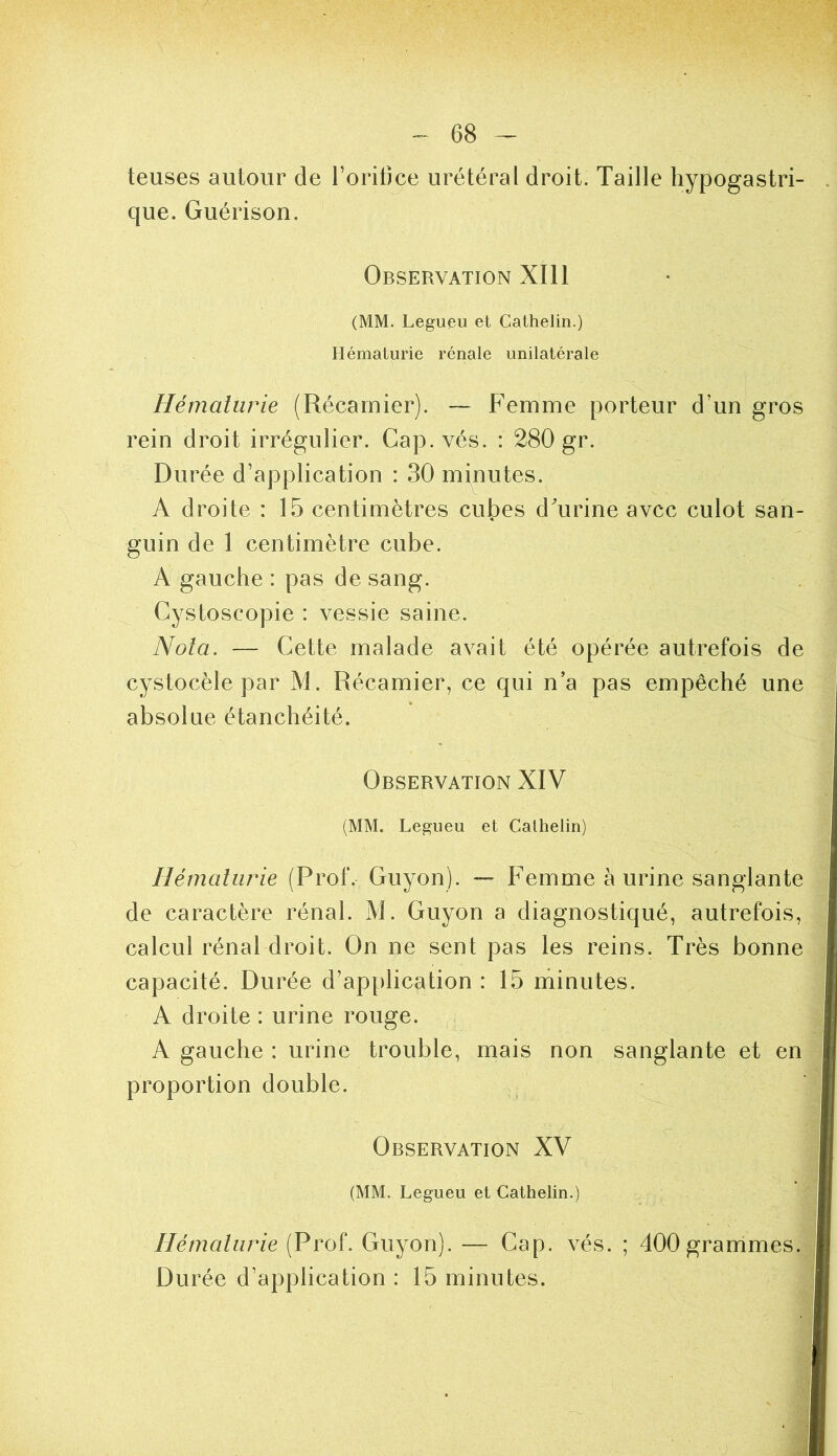 teuses autour de Toritjce urétéral droit. Taille hypogastri- que. Guérison. Observation XIll (MM. Legueu et Cathelin.) Hématurie rénale unilatérale Hématurie (Récarnier). — Femme porteur d’un gros rein droit irrégulier. Cap. vés. : 280 gr. Durée d’application : 30 minutes. A droite : 15 centimètres cubes d'urine avec culot san- guin de 1 centimètre cube. A gauche : pas de sang. Cystoscopie : vessie saine. Nota. — Cette malade avait été opérée autrefois de cystocèle par M. Récarnier, ce qui n’a pas empêché une absolue étanchéité. Observation XIV (MM. Legueu et Cathelin) Hématurie (Prof. Guyon). — Femme à urine sanglante de caractère rénal. M. Guyon a diagnostiqué, autrefois, calcul rénal droit. On ne sent pas les reins. Très bonne capacité. Durée d’application : 15 minutes. A droite : urine rouge. A gauche : urine trouble, mais non sanglante et en proportion double. Observation XV (MM. Legueu et Cathelin.) Hématurie (Prof. Guyon). — Cap. vés. ; 400 grammes. Durée d’application : 15 minutes.