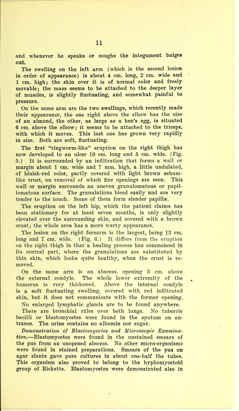 and whenever he speaks or coughs the integument bulges out. The swelling on the left arm (which is the second lesion in order of appearance) is about 4 cm. long, 2 cm. wide and 1 cm. high; the skin over it is of normal color and freely movable; the mass seems to be attached to the deeper layer of muscles, is slightly fluctuating, and somewhat painful to pressure. On the same arm are the two swellings, which recently made their appearance, the one right above the elbow has the size of an almond, the other, as large as a hen’s egg, is situated 6 cm. above the elbow; it seems to be attached to the triceps, with which it moves. This last one has grown very rapidly in size. Both are soft, fluctuating. The first “ringworm-like” eruption on the right thigh has now developed to an ulcer 10 cm. long and 5 cm. wide. (Fig. 5.) It is surrounded by an infiltration that forms a wall or margin about 1 cm. wide and 7 mm. high, a little undulated, of bluish-red color, partly covered with light brown sebum- like crust, on removal of which fine openings are seen. This wall or margin surrounds an uneven granulomatous or papil- lomatous surface. The granulations bleed easily and are very tender to the touch. Some of them form slender papillae. The eruption on the left hip, which the patient claims lias been stationary for at least seven months, is only slightly elevated over the surrounding skin, and covered with a brown crust; the whole area has a more warty appearance. The lesion on the right forearm is the largest, being 13 cm. long and 7 cm. wide. (Fig. 6.) It differs from the eruption on the right thigh in that a healing process has commenced in its central part, where' the granulations are substituted by thin skin, which looks quite healthy, when the crust is re- moved. On the same arm is an abscess, opening 5 cm. above the external condyle. The whole lower extremity of the humerus is very thickened. Above the internal condyle is a soft fluctuating swelling, covered with red infiltrated skin, but it does not communicate with the former opening. No enlarged lymphatic glands are to be found anywhere. There are bronchial rhles over both lungs. No tubercle bacilli or blastomycetes were found in the sputum on en- trance. The urine contains no albumin nor sugar. Demonstration of Blastomycetes and Microscopic Examina- tion.—Blastomycetes were found in the unstained smears of the pus from an unopened abscess. No other micro-organisms were found in stained preparations. Smears of the pus on agar slants gave pure cultures in about one-h^lf the tubes. This organism also proved to belong to the hyphomycetoid group of Ricketts. Blastomycetes were demonstrated also in