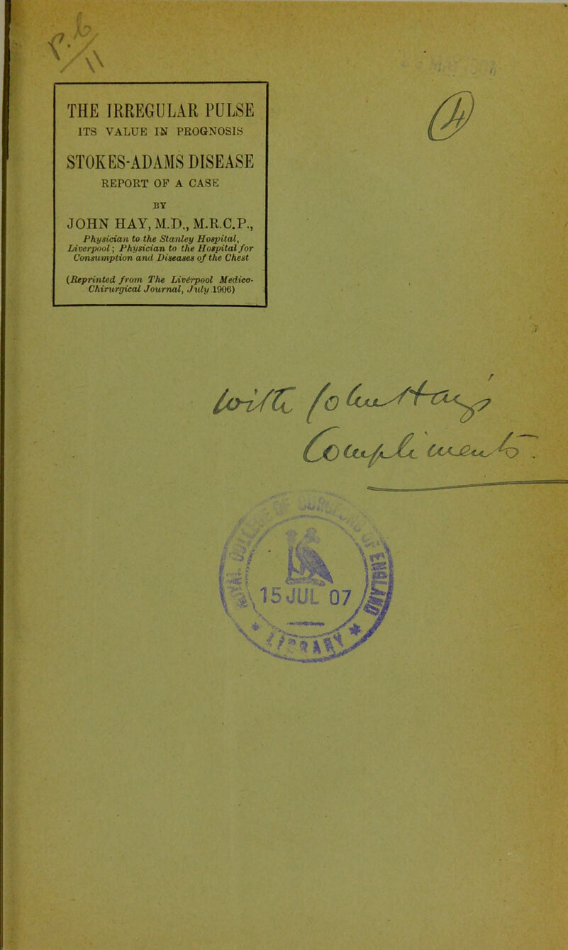 / THE IRREGULAR PULSE ITS VALUE IN PROGNOSIS STOKES-ADAMS DISEASE REPORT OF A CASE BY JOHN HAY, M.D., M.R.C.P., Physician to the Stanley Hospital, Liverpool-, Physician to the Hospital for Consumption and Diseases of the Chest (Reprinted from The Liverpool Medico- Chiruryieal Journal, July lOW) lon/ti Ccfu2<^A^