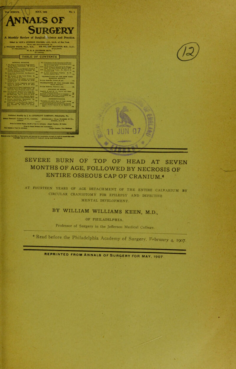 _ *'‘'*f*OM&* SEVERE BURN OF TOP OF HEAD AT SEVEN MONTHS OF AGE, FOLLOWED BY NECROSIS OF ENTIRE OSSEOUS CAP OF CRANIUM.4 AT FOURTEEN YEARS OF AGE DETACHMENT OF THE ENTIRE CALVARIUM BY CIRCULAR CRANIOTOMY FOR EPILEPSY AND DEFECTIVE MENTAL DEVELOPMENT. BY WILLIAM WILLIAMS KEEN, M.D., OF PHILADELPHIA. Professor of Surgery in the Jefferson Medical College. Read before the Philadelphia Academy of Surgery. February 4. 1 907. SCPRINTED FROM ANNALS OF SURGERY FOR MAY. 1907 V