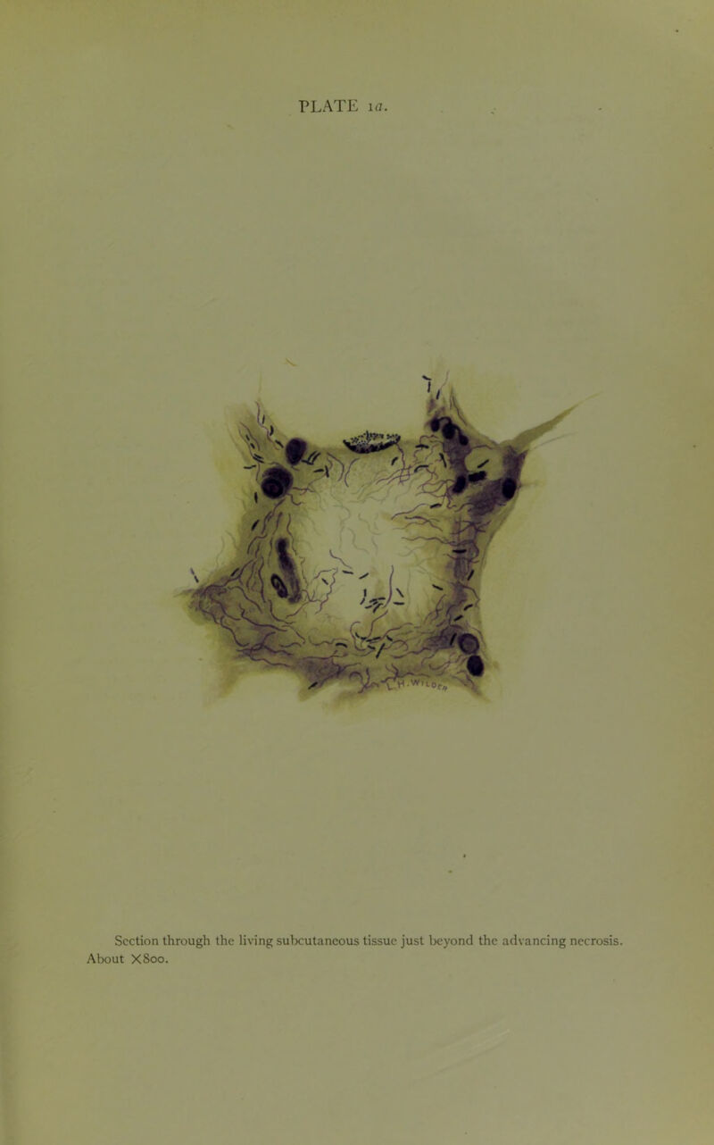 PLATE la. Section through the living subcutaneous tissue just beyond the advancing necrosis. About X8oo.