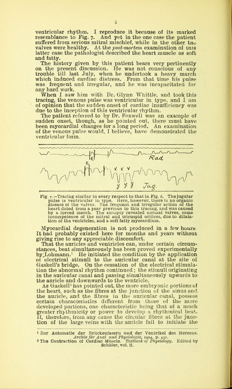 resemblance to Fig. 7. And yet in the one case the patient suffered from serious mitral mischief, while in the other tno valves were healthy. At the 'post-mortem examination of inis latter case the pathologist described the heart muscle as soft and fatty. The history given by this patient bears very pertinently on the present discussion. He was not conscious of any trouble till last July, when he undertook a heavy march which induced cardiac distress. From that time his pulse was frequent and irregular, and he was incapacitated, for any hard work. When I saw him with Dr, Glynn Whittle, and took this tracing, the venous pulse was ventricular in type, and I am of opinion that the sudden onset of cardiac insufficiency was due to the inception of this ventricular rhythm. The patient referred to by Dr. Foxwell was an example of sudden onset, though, as he pointed out, there must have been myocardial changes for a long period. An examination of the venous pulse would, I believe, have demonstrated the ventricular form. Fig. 7.—Tracing similar in every respect to that in Fig. 6. The jugular pulse is ventricular in type. Here, however, there is no organic disease oi the valves. Tne frequent and irregular action of the heart dated from a year previous to this tracing, and was caused by a forced march. The autopsy revealed noruial valves, some incompetence of the mitral and tricuspid orifices, due to dilata- tion of the ventricles, and a soft fatty myocardium. Myocardial degeneration is not produced in a few hours- It had probably existed here for months and years without giving rise to any appreciable discomfort. That the auricles and ventricles can, under certain circum- stances, beat simultaneously has been proved experimentally by;Lohmann.^ He initiated the condition by the application of electrical stimuli to the auricular canal at the site of Gaskell’s bridge. On the cessation of the electrical stimula- tion the abnormal rhythm continued; the stimuli originating in the auricular canal and passing simultaneously upwards to the auricle and downwards to the ventricle. As GaakelP has pointed out, the more embry onic portions of the heart, such as the fibres at the junction of the sinus and the auricle, and the fibres in the auricular canal, possess certain characteriatics different from those of the more developed portions, one characteristic being that of a much greater rhythmicity or power to develop a rhythmical beat. If, therefore, from any cause the circular fibres at the junc- tion of the large veins with the auricle fail to initiate the 1 Zur Automatie der Briickenfasern und der Ventrikel des Herzens. Archiv fUr Anat und Physiologic, 1904. p. 431. 2 The Contraction of Cardiac Muscle. Textbook of Physiology. Edited by Schafer, vol, ii.