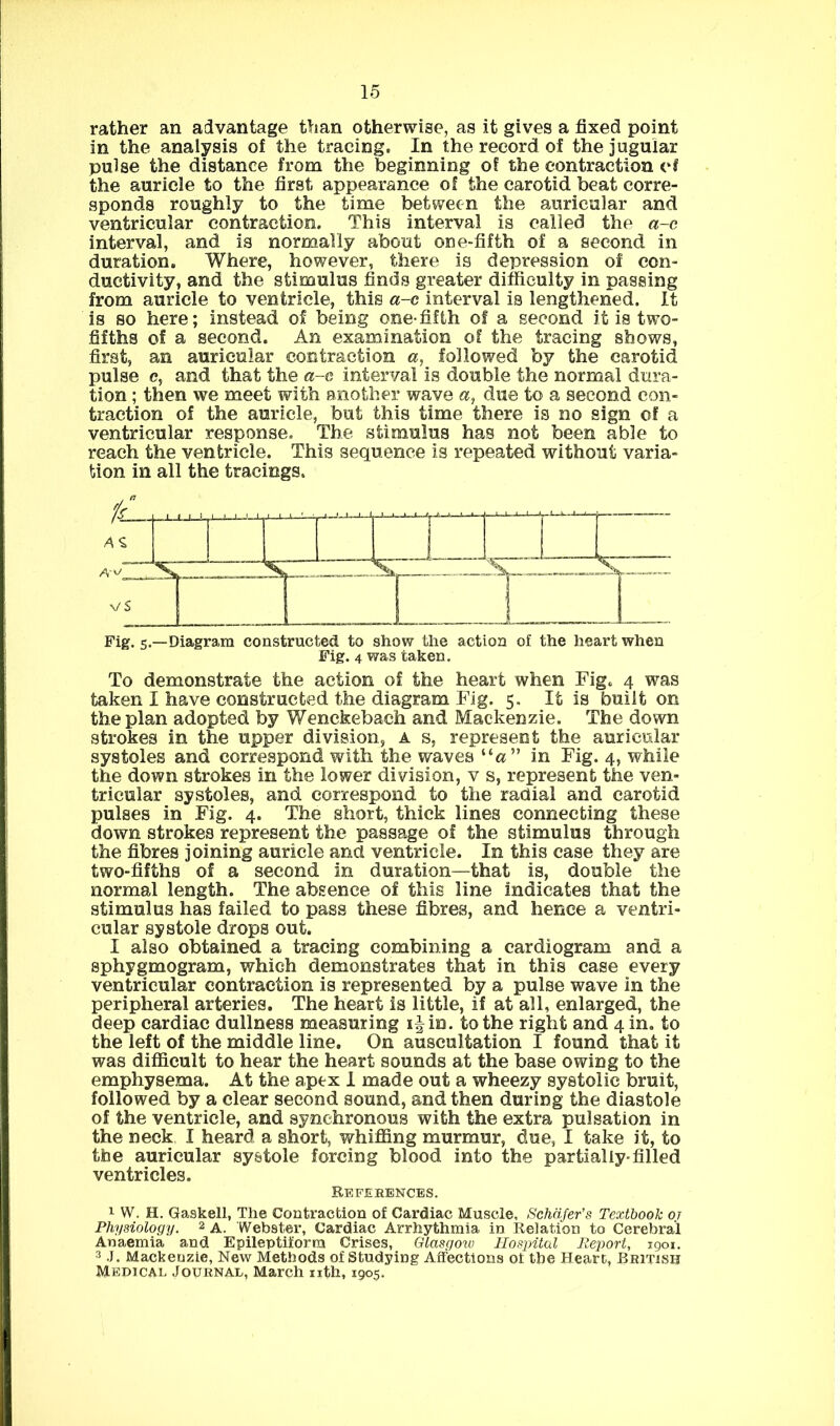 rather an advantage than otherwise, as it gives a fixed point in the analysis of the tracing. In the record of the jugular pulse the distance from the beginning of the contraction vl the auricle to the first appearance of the carotid beat corre- sponds roughly to the time between the auricular and ventricular contraction. This interval is called the a-e interval, and is normally about one-fifth of a second in duration. Where, however, there is depression of con- ductivity, and the stimulus finds greater difficulty in passing from auricle to ventricle, this a-c interval is lengthened. It is so here; instead of being one-fifth of a second it is two- fifths of a second. An examination of the tracing shows, first, an auricular contraction a, followed by the carotid pulse c, and that the a-e interval is double the normal dura- tion ; then we meet with another wave a, due to a second con- traction of the auricle, but this time there is no sign of a ventricular response. The stimulus has not been able to reach the ventricle. This sequence is repeated without varia- tion in all the tracings. Fig. 5.—Diagram constructed to show the action of the heart when Fig. 4 was taken. To demonstrate the action of the heart when Fig. 4 was taken I have constructed the diagram Fig. 5. It is built on the plan adopted by Wenckebach and Mackenzie. The down strokes in the upper division, a s, represent the auricular systoles and correspond with the waves in Fig. 4, while the down strokes in the lower division, v s, represent the ven- tricular systoles, and correspond to the radial and carotid pulses in Fig. 4. The short, thick lines connecting these down strokes represent the passage of the stimulus through the fibres joining auricle and ventricle. In this case they are two-fifths of a second in duration—that is, double the normal length. The absence of this line indicates that the stimulus has failed to pass these fibres, and hence a ventri- cular systole drops out. I also obtained a tracing combining a cardiogram and a sphygmogram, which demonstrates that in this case every ventricular contraction is represented by a pulse wave in the peripheral arteries. The heart is little, if at all, enlarged, the deep cardiac dullness measuring i|in. to the right and 4 in. to the left of the middle line. On auscultation I found that it was difficult to hear the heart sounds at the base owing to the emphysema. At the apex I made out a wheezy systolic bruit, followed by a clear second sound, and then during the diastole of the ventricle, and synchronous with the extra pulsation in the neck I heard a short, whiffing murmur, due, I take it, to the auricular systole forcing blood into the partially-filled ventricles. Refekencbs. 1 W. H. Gaskell, The Contraction of Cardiac Muscle, Schafer's Textbook oj Physiology. 2 a. Webster, Cardiac Arrhythmia in Relation to Cerebral Anaemia and Epileptiform Crises, Glasgow Hospital Report, 1901. 3 J. Mackenzie, New Methods of Studying Affections of the Heart, British Medical Journal, March nth, 1905.