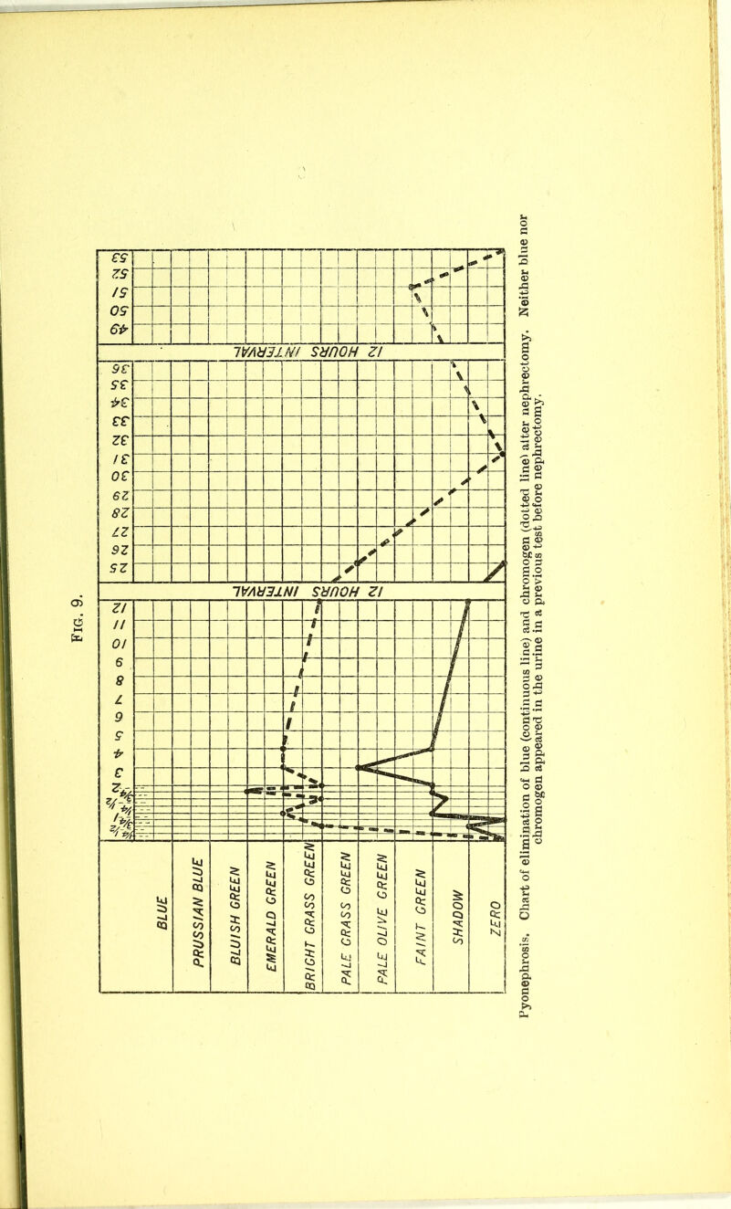 €8 n 1 7* ZS IS Pi J \ r OS i \ i □ □ ! 1 .aj j IVAidSlN! SUDOH ’ ZI 9 V 1 % \ 88 rr ZE /£ or 6Z 8Z ZZ 9Z SZ | 1 * \ V \ p ** a * * ► A y A Z 1VAUS1N! StmOH Zi ZI // 0/ 6 8 Z 9 8 ir C % \ | 1 / i if r § f ! \ — 1 i blue: PRUSSIAN BLUE BLUISH GREEN EMERALD GREEN BRIGHT CRASS GREEN PALE CRASS GREEN ~\ 1 PALE OLIVE GREEN FAINT GREEN SHADOW 1 ZERO Pyonephrosis. Chart of elimination of blue (continuous line) and chromogen (dotted linei alter nephrectomy. Neither blue nor chromogen appeared in the urine in a previous test before nephrectomy.
