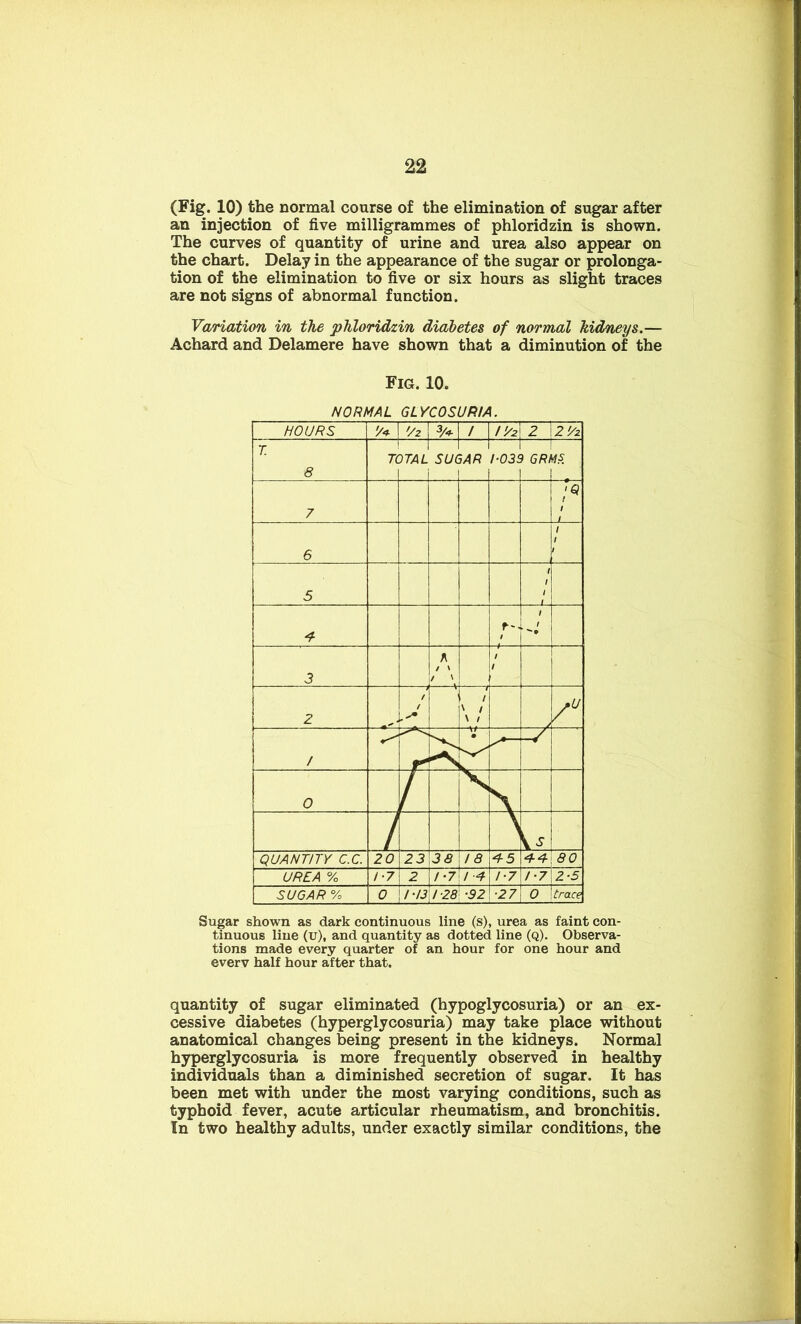 (Fig. 10) the normal course of the elimination of sugar after an injection of five milligrammes of phloridzin is shown. The curves of quantity of urine and urea also appear on the chart. Delay in the appearance of the sugar or prolonga- tion of the elimination to five or six hours as slight traces are not signs of abnormal function. Variation in the phloridzin diabetes of normal kidneys.— Achard and Delamere have shown that a diminution of the Fig. 10. Sugar shown as dark continuous line (s), urea as faint con- tinuous line (u), and quantity as dotted line (q). Observa- tions made every quarter of an hour for one hour and everv half hour after that. quantity of sugar eliminated (hypoglycosuria) or an ex- cessive diabetes (hyperglycosuria) may take place without anatomical changes being present in the kidneys. Normal hyperglycosuria is more frequently observed in healthy individuals than a diminished secretion of sugar. It has been met with under the most varying conditions, such as typhoid fever, acute articular rheumatism, and bronchitis. In two healthy adults, under exactly similar conditions, the