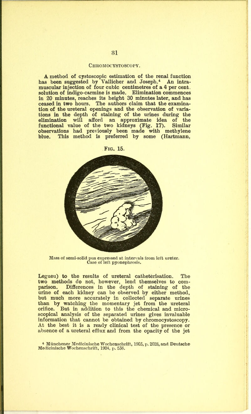 Chromocystoscopy. A method of cystoscopic estimation of the renal function has been suggested by Vallicher and Joseph.4 An intra- muscular injection of four cubic centimetres of a 4 per cent, solution of indigo-carmine is made. Elimination commences in 20 minutes, reaches its height 30 minutes later, and has ceased in two hours. The authors claim that the examina- tion of the ureteral openings and the observation of varia- tions in the depth of staining of the urines during the elimination will afford an approximate idea of the functional value of the two kidneys (Fig. 17). Similar observations had previously been made with methylene blue. This method is preferred by some (Hartmann, Fig. 15. Mass of semi-solid pus expressed at intervals from left ureter. Case of left pyonephrosis. Legueu) to the results of ureteral catheterisation. The two methods do not, however, lend themselves to com- parison. Differences in the depth of staining of the urine of each kidney can be observed by either method, but much more accurately in collected separate urines than by watching the momentary jet from the ureteral orifice. But in addition to this the chemical and micro- scopical analysis of the separated urines gives invaluable information that cannot be obtained by chromocystoscopy. At the best it is a ready clinical test of the presence or absence of a ureteral efflux and from the opacity of the jet 4 Miinchener Medicinische Wochenschrift, 1903, p. 2028, and Deutsche Medicinische Wochenschrift, 1904, p. 536.
