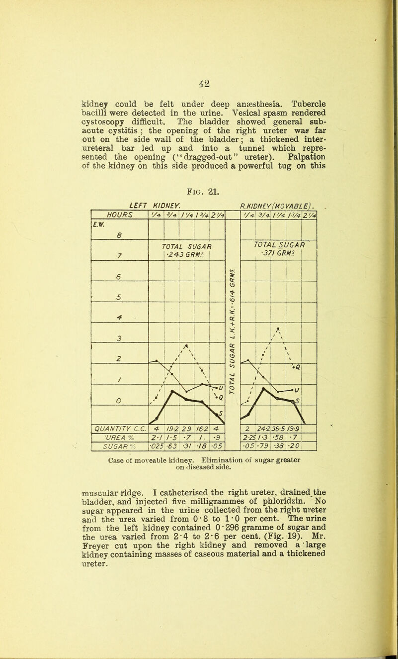 kidney could be felt under deep anaesthesia. Tubercle bacilli were detected in the urine. Vesical spasm rendered cystoscopy difficult. The bladder showed general sub- acute cystitis ; the opening of the right ureter was far out on the side wall of the bladder; a thickened inter- ureteral bar led up and into a tunnel which repre- sented the opening (“ dragged-out ” ureter). Palpation of the kidney on this side produced a powerful tug on this Fig. 21. Case of moveable kidney. Elimination of sugar greater on diseased side. muscular ridge. I catheterised the right ureter, drained the bladder, and injected five milligrammes of phloridzin. No sugar appeared in the urine collected from the right ureter and the urea varied from 0 • 8 to 1 • 0 per cent. The urine from the left kidney contained 0 * 296 gramme of sugar and the urea varied from 2'4 to 2*6 per cent. (Fig. 19). Mr. Freyer cut upon the right kidney and removed a ‘ large kidney containing masses of caseous material and a thickened ureter.