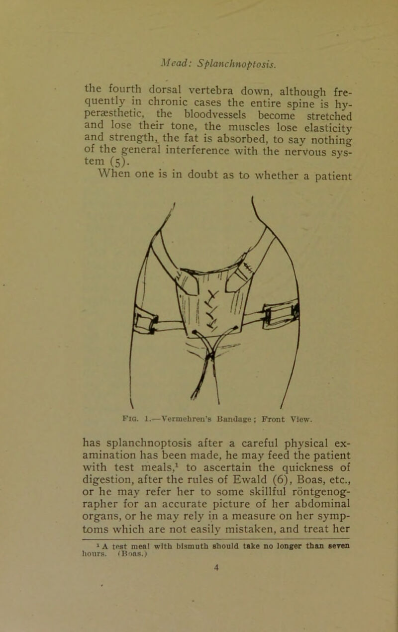 the fourth dorsal vertebra down, although fre- quently in chronic cases the entire spine is hy- persesthetic, the bloodvessels become stretched and lose their tone, the muscles lose elasticity and strength, the fat is absorbed, to say nothing of the general interference with the nervous sys- tem (5). When one is in doubt as to whether a patient Fig. 1.—Vermeliren’s Bandage ; Front View. has splanchnoptosis after a careful physical ex- amination has been made, he may feed the patient with test meals,1 to ascertain the quickness of digestion, after the rules of Ewald (6), Boas, etc., or he may refer her to some skillful rontgenog- rapher for an accurate picture of her abdominal organs, or he may rely in a measure on her symp- toms which are not easily mistaken, and treat her 1 A test meal with bismuth should take no longer than seven hours. (Boas.)