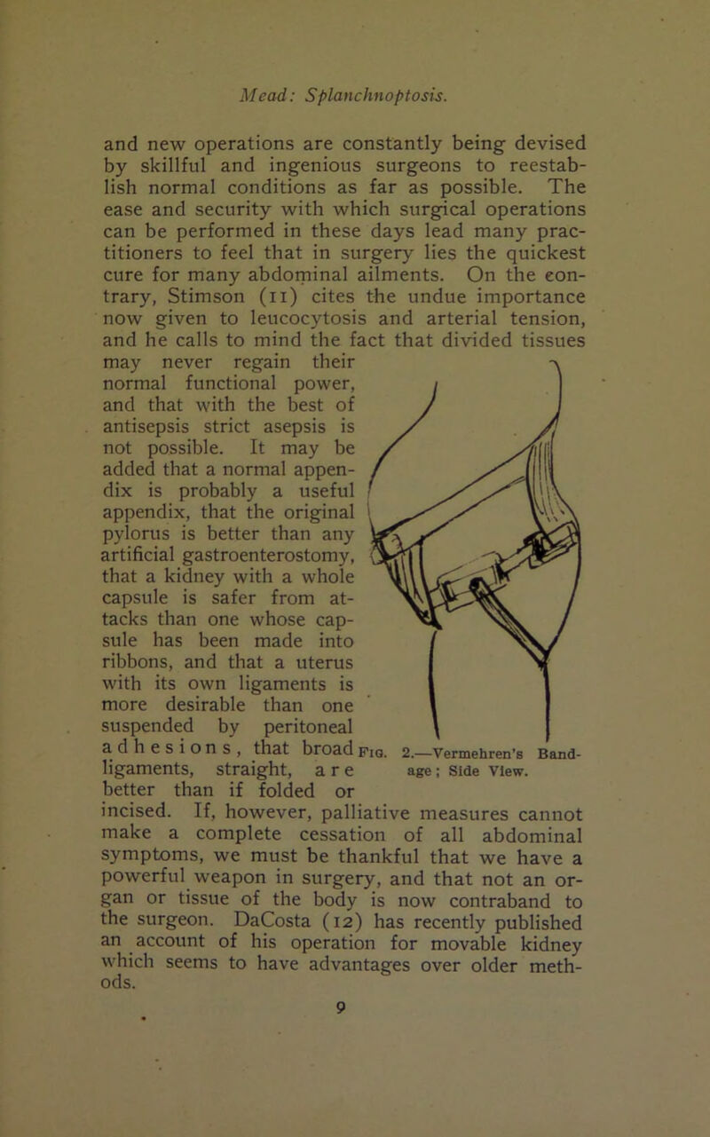 and new operations are constantly being devised by skillful and ingenious surgeons to reestab- lish normal conditions as far as possible. The ease and security with which surgical operations can be performed in these days lead many prac- titioners to feel that in surgery lies the quickest cure for many abdominal ailments. On the con- trary, Stimson (n) cites the undue importance now given to leucocytosis and arterial tension, and he calls to mind the fact that divided tissues may never regain their normal functional power, and that with the best of antisepsis strict asepsis is not possible. It may be added that a normal appen- dix is probably a useful appendix, that the original pylorus is better than any artificial gastroenterostomy, that a kidney with a whole capsule is safer from at- tacks than one whose cap- sule has been made into ribbons, and that a uterus with its own ligaments is more desirable than one suspended by peritoneal adhesions, that broadpiq, 2.—Vermehren’s Band- ligaments, straight, are age; Side View, better than if folded or incised. If, however, palliative measures cannot make a complete cessation of all abdominal symptoms, we must be thankful that we have a powerful weapon in surgery, and that not an or- gan or tissue of the body is now contraband to the surgeon. DaCosta (12) has recently published an account of his operation for movable kidney which seems to have advantages over older meth- ods.
