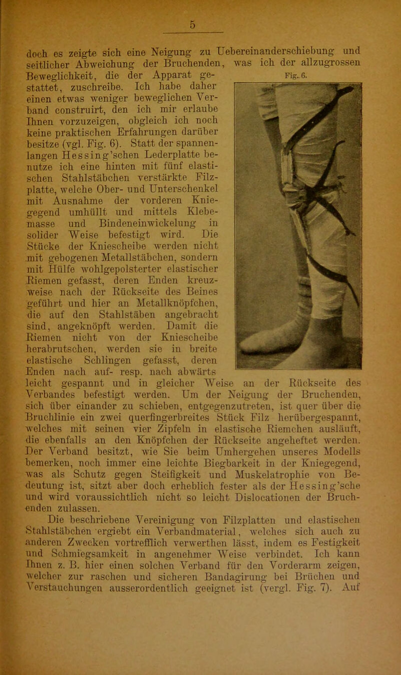 doch es zeigte sich eine Neigung zu Uebereinanderschiebung und seitlicher Abweichung der Bruchenden, was ich der allzugrossen Beweglichkeit, die der Apparat ge- Fig. 6. stattet, zuschreibe. Ich habe daher einen etwas weniger beweglichen Ver- band construirt, den ich mir erlaube Ihnen vorzuzeigen, obgleich ich noch keine praktischen Erfahrungen darüber besitze (vgl. Fig. 6). Statt der spannen- langen Hessing’schen Lederplatte be- nutze ich eine hinten mit fünf elasti- schen Stahlstäbchen verstärkte Filz- platte, welche Ober- und Unterschenkel mit Ausnahme der vorderen Knie- gegend umhüllt und mittels Klebe- masse und Bindeneinwickelung in solider Weise befestigt wird. Die Stücke der Kniescheibe werden nicht mit gebogenen Metallstäbchen, sondern mit Hülfe wohlgepolsterter elastischer (Riemen gefasst, deren Enden kreuz- weise nach der Rückseite des Beines geführt und hier an Metallknöpfchen, die auf den Stahlstäben angebracht sind, angeknöpft werden. Damit die Riemen nicht von der Kniescheibe herabrutschen, werden sie in breite elastische Schlingen gefasst, deren Enden nach auf- resp. nach abwärts leicht gespannt und in gleicher Weise an der Rückseite des Vorbandes befestigt werden. Um der Neigung der Bruchenden, sich über einander zu schieben, entgegen zutreten, ist quer über die Bruchlinie ein zwei querfingerbreites Stück Filz herübergespannt, welches mit seinen vier Zipfeln in elastische Riemchen ausläuft, die ebenfalls an den Knöpfchen der Rückseite angeheftet werden. Der Verband besitzt, wie Sie beim Umhergehen unseres Modells bemerken, noch immer eine leichte Biegbarkeit in der Kniegegend, was als Schutz gegen Steifigkeit und Muskelatrophie von Be- deutung ist, sitzt aber doch erheblich fester als der Hessing’sche und wird voraussichtlich nicht so leicht Dislocationen der Bruch- enden zulassen. Die beschriebene Vereinigung von Filzplatten und elastischen Stahlstäbchen ergiebt ein Verbandmaterial, welches sich auch zu anderen Zwecken vortrefflich verwerthen lässt, indem es Festigkeit und Schmiegsamkeit in angenehmer Weise verbindet. Ich kann Ihnen z. B. hier einen solchen Verband für den Vorderarm zeigen, welcher zur raschen und sicheren Bandagirung bei Brüchen und Verstauchungen ausserordentlich geeignet ist (vergl. Fig. 7). Auf