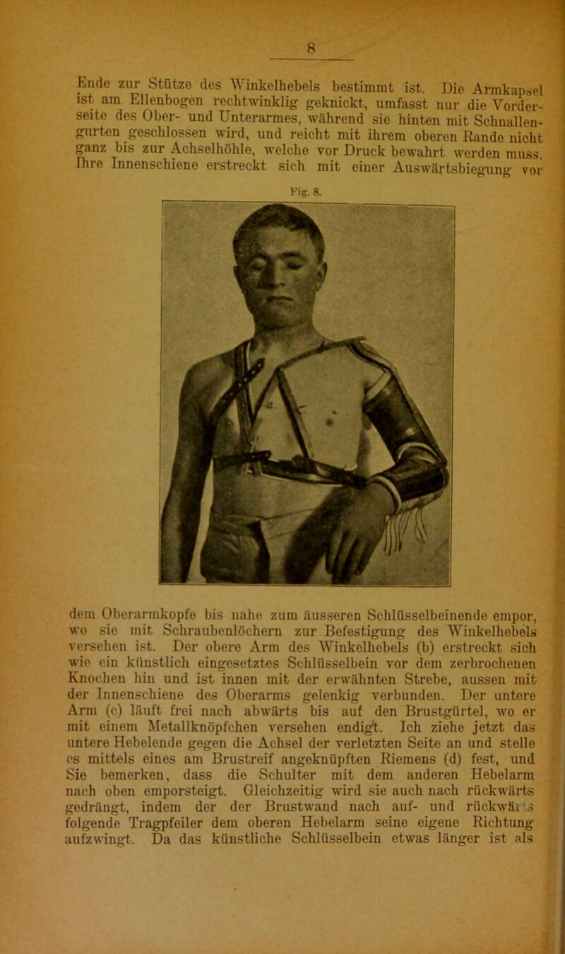 Ende zur Stütze des Winkelhebels bestimmt ist. Die Armkapsel ist, am Ellenbogen rechtwinklig geknickt, umfasst nur die Vorder- seite des Ober- und Unterarmes, während sie hinten mit Schnalleu- gurten geschlossen wird, und reicht mit ihrem oberen Rande nicht ganz bis zur Achselhöhle, welche vor Druck bewahrt werden muss. Ihre Innenschieno erstreckt sich mit einer Auswärtsbiegung vor Kig. 8. dem Oberarmkopfe bis nahe zum äusseren Schlüsselbcinende empor, wo sio mit Schraubenlöchern zur Befestigung des Winkelhebels versehen ist. Der obere Arm des Winkelhebels (b) erstreckt sich wie ein künstlich eingesetztes Schlüsselbein vor dem zerbrochenen Knochen hin und ist innen mit der erwähnten Strebe, aussen mit der Innenschiene des Oberarms gelenkig verbunden. Der untere Arm (c) läuft frei nach abwärts bis auf den Brustgürtel, wo er mit einem Metallknöpfchen versehen endig*t. Ich ziehe jetzt das untere Hebelende gegen die Achsel der verletzten Seite an und stelle es mittels eines am Brustreif angoknüpften Riemens (d) fest, und Sio bemerken, dass die Schulter mit dem anderen Hebelarm nach oben emporsteigt. Gleichzeitig wird sie auch nach rückwärts gedrängt, indem der der Brustwand nach auf- und rückwäi s folgende Tragpfeiler dem oberen Hebelarm seine eigene Richtung aufzwingt. Da das künstliche Schlüsselbein etwas länger ist als