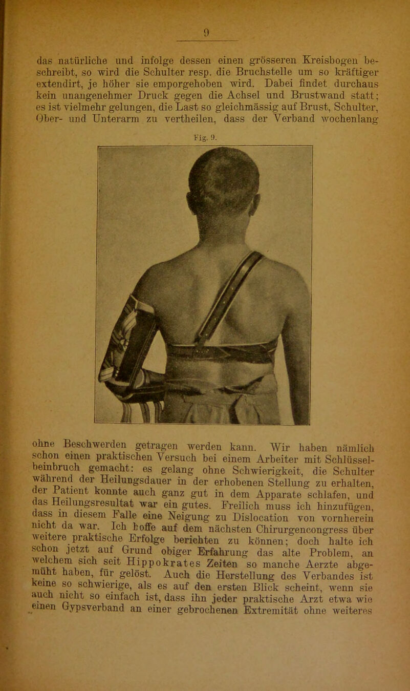 das natürliche und infolge dessen einen grösseren Kreisbogen be- schreibt, so wird die Schulter resp. die Bruchstelle um so kräftiger extendirt, je höher sie emporgehoben wird. Dabei findet durchaus kein unangenehmer Druck gegen die Achsel und Brustwand statt; es ist vielmehr gelungen, die Last so gleichmässig auf Brust, Schulter, Ober- und Unterarm zu vertlieilen, dass der Verband wochenlang Kig. !). ohne Beschwerden getragen werden kann. Wir haben nämlich schon einen praktischen \ ersuch bei einem Arbeiter mit Schlüssel- beinbruch gemacht: es gelang ohne Schwierigkeit, die Schulter wahrend der Heilungsdauer in der erhobenen Stellung zu erhalten, 1 ei 1 atient konnte auch ganz gut in dem Apparate schlafen, und das Heilungsresultat war ein gutes. Freilich muss ich hinzufügen, (ass m diesem halle eine Neigung zu Dislocation von vornherein nicht da war. Ich hoffe auf dem nächsten Chirurgencongress über weitere praktische Erfolge berichten zu können; doch halte ich schon jetzt auf Grund obiger Erfahrung das alte Problem, an welchem sich seit Hippokrates Zeiten so manche Aerzte abge- muht haben, für gelöst. Auch dio Herstellung des Verbandes ist eine so schwierige, als es auf den ersten Blick scheint, wenn sie auch nicht so einfach ist, dass ihn jeder praktische Arzt etwa wie einen Gypsverband an einer gebrochenen Extremität ohne weiteres