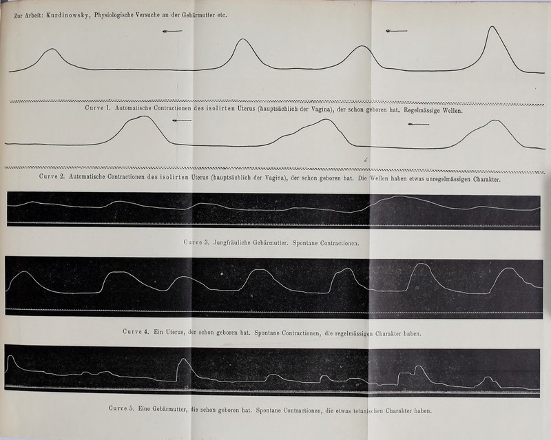 WAV-WwV,' M\1.WAVVkV^*wV-V.V Curve 2. Automatische Contractionen des isolirten Uterus (hauptsächlich der Vagina), der schon geboren hat. Die Wellen haben etwas unregelmässigen Charakter. Curve 3. Jungfräuliche Gebärmutter. Spontane Contractionen. Curve 4. Ein Uterus, der schon geboren hat. Spontane Contractionen, die regelmässigen Charakter haben. tat