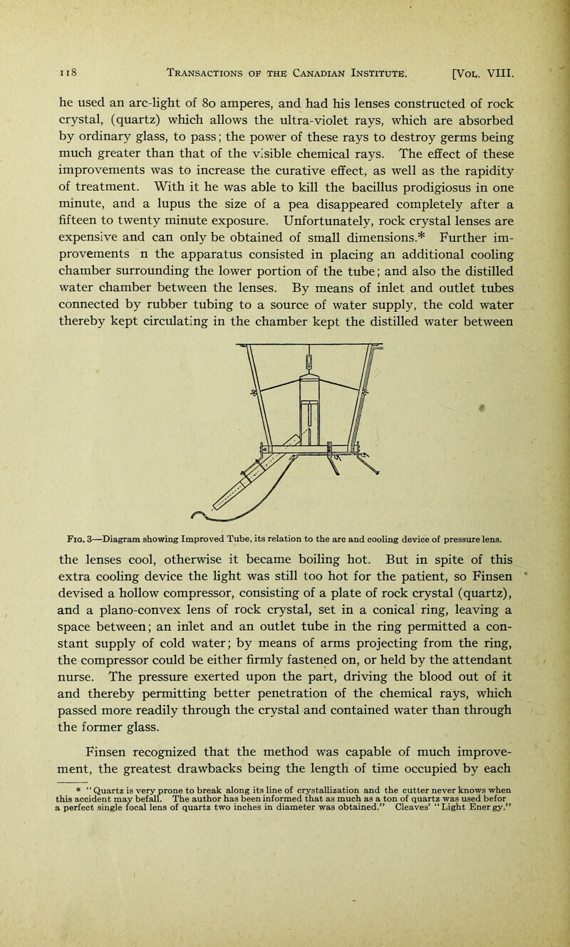 he used an arc-light of 8o amperes, and had his lenses constructed of rock crystal, (quartz) which allows the ultra-violet rays, which are absorbed by ordinary glass, to pass; the power of these rays to destroy germs being much greater than that of the visible chemical rays. The effect of these improvements was to increase the curative effect, as well as the rapidity of treatment. With it he was able to kill the bacillus prodigiosus in one minute, and a lupus the size of a pea disappeared completely after a fifteen to twenty minute exposure. Unfortunately, rock crystal lenses are expensive and can only be obtained of small dimensions.* Further im- provements n the apparatus consisted in placing an additional cooling chamber surrounding the lower portion of the tube; and also the distilled water chamber between the lenses. By means of inlet and outlet tubes connected by rubber tubing to a source of water supply, the cold water thereby kept circulating in the chamber kept the distilled water between Fig. 3—Diagram showing Improved Tube, its relation to the arc and cooling device of pressure lens. the lenses cool, otherwise it became boiling hot. But in spite of this extra cooling device the light was still too hot for the patient, so Finsen devised a hollow compressor, consisting of a plate of rock crystal (quartz), and a plano-convex lens of rock crystal, set in a conical ring, leaving a space between; an inlet and an outlet tube in the ring permitted a con- stant supply of cold water; by means of arms projecting from the ring, the compressor could be either firmly fastened on, or held by the attendant nurse. The pressure exerted upon the part, driving the blood out of it and thereby permitting better penetration of the chemical rays, which passed more readily through the crystal and contained water than through the former glass. Finsen recognized that the method was capable of much improve- ment, the greatest drawbacks being the length of time occupied by each ♦ “ Quartz is very prone to break along its line of crystallization and the cutter never knows when this accident may bef^l. The author has been informed that as much as a ton of quartz was used bef or a perfect single focal lens of quartz two inches in diameter was obtained.” Cleaves’ “Light Energy.”