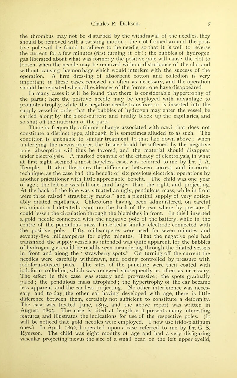 the thrombus may not be disturbed by the withdrawal of the needles, they should be removed with a twisting motion ; the clot formed around the posi- tive pole will be found to adhere to the needle, so that it is well to reverse the current for a few minutes (first turning it off) ; the bubbles of hydrogen gas liberated about what was formerly the positive pole will cause the clot to loosen, when the needle may be removed without disturbance of the clot and without causing haemorrhage which would interfere with the success of the operation. A firm dressing of absorbent cotton and collodion is very important in these cases, renewed as often as necessary, and the operation should be repeated when all evidences of the former one have disappeared. In many cases it will be found that there is considerable hypertrophy of the parts ; here the positive needle may be employed with advantage to promote atrophy, while the negative needle transfixes or is inserted into the supply vessel in order that the bubbles of hydrogen may enter the vessel, be carried along by the blood-current and finally block up the capillaries, and so shut off the nutrition of the parts. There is frequently a fibrous change associated with nsevi that does not constitute a distinct type, although it is sometimes alluded to as such. The condition is amenable to similar treatment to that laid down above ; when underlying the ntevus proper, the tissue should be softened by the negative pole, absorption will thus be favored, and the material should disappear under electrolysis. A marked example of the efficacy of electrolysis, in what at first sight seemed a most hopeless case, was referred to me by Dr. J. A. Temple. It also illustrates the difference between correct and incorrect technique, as the case had the benefit of six previous electrical operations by another practitioner with little appreciable benefit. The child was one year of age ; the left ear was full one-third larger than the right, and projecting. At the back of the lobe was situated an ugly, pendulous mass, while in front were three raised “strawberry marks,” and a plentiful supply of very notice- ably dilated capillaries. Chloroform having been administered, on careful examination 1 detected a spot on the back of the ear where, by pressure, I could lessen the circulation through the blemishes in front. In this I inserted a gold needle connected with the negative pole of the battery, while in the centre of the pendulous mass I inserted a similar electrode connected with the positive pole. Fifty milleamperes were used for seven minutes, and seventy-five milleamperes for eight minutes. That the negative pole had transfixed the supply vessels as intended was quite apparent, for the bubbles of hydrogen gas could be readily seen meandering through the dilated vessels in front and along the “ strawberry spots.” On turning off the current the needles were carefully withdrawn, and oozing controlled by pressure with iodoform-dusted pads. The sites of the puncture were then coated with iodoform collodion, which was renewed subsequently as often as necessary. The effect in this case was steady and progressive ; the spots gradually paled ; the pendulous mass atrophied ; the hypertrophy of the ear became less apparent, and the ear less projecting. No other interference was neces- sary, and to-day, the other ear having developed with age, there is little difference between them, certainly not sufficient to constitute a deformity. The case was treated June, 1893, and the above report was written in August, 1895. The case is cited at length as it presents many interesting features, and illustrates the indications for use of the respective poles. (It will be noticed that gold needles were employed. I now use irido-platinum ones.) In April, 1892, I operated upon a case referred to me by Dr. G. S. Ryerson. The child was eight months of age and had a very disfiguring vascular projecting naevus the size of a small bean on the left upper eyelid,