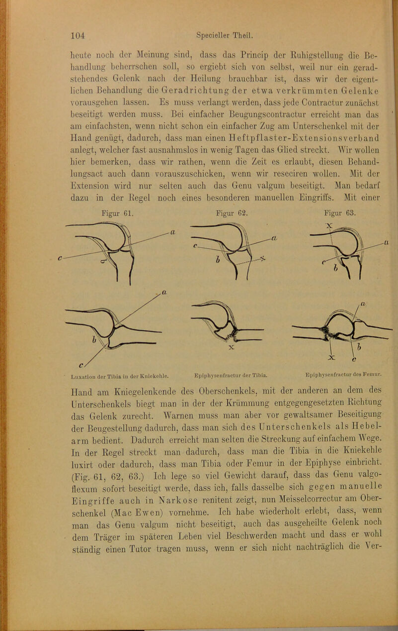 licutc nocli der Meinung sind, dass das Princip der Ruliigstellung die ße- luindlung belicrrsclien soll, so ergiebt sieb von selbst, weil nur ein gerad- steliendes Gelenk nach der Heilung brauchbar ist, dass wir der eigent- lichen Behandlung die Geradrichtung der etwa verkrümmten Gelenke vorausgehen lassen. Es muss verlangt werden, dass jede Contractur zunächst beseitigt werden muss. Bei einfacher Beugungscontractur erreicht man das am einfachsten, wenn nicht schon ein einfacher Zug am Unterschenkel mit der Hand genügt, dadurch, dass man einen Heftpflaster-Extensionsverband anlegt, welcher fast ausnahmslos in wenig Tagen das Glied streckt. AVir wollen hier bemerken, dass wir rathen, wenn die Zeit es erlaubt, diesen Behand- lungsact auch dann vorauszuschicken, wenn wir reseciren wollen. Mit der Extension wird nur selten auch das Genu valgum beseitigt. Man bedarf dazu in der Regel noch eines besonderen manuellen Eingriffs. Mit einer Figur 61. Figur 62. Figur 63. Hand am Kniegelenkende des Oberschenkels, mit der anderen an dem des Unterschenkels biegt man in der der Krümmung entgegengesetzten Richtung das Gelenk zurecht. Warnen muss man aber vor gewaltsamer Beseitigung der Beugestellung dadurch, dass man sich des Unterschenkels als Hebel- arm bedient. Dadurch erreicht man selten die Streckung auf einfachem AVege. In der Regel streckt man dadurch, dass man die Tibia in die Kniekehle luxirt oder dadurch, dass man Tibia oder Femur in der Epiphyse einbricht. (Fig. 61, 62, 63.) Ich lege so viel Gewicht darauf, dass das Genu valgo- flexum sofort beseitigt werde, dass ich, falls dasselbe sich gegen manuelle Eingriffe auch in Narkose renitent zeigt, nun Meisselcorrectur am Ober- schenkel (Mac Ewen) vornekme. Ich habe wiederholt erlebt, dass, wenn man das Genu valgum nicht beseitigt, auch das ausgeheilte Gelenk noch dem Träger im späteren Leben viel Beschwerden macht und dass er wohl ständig einen Tutor tragen muss, wenn er sich nicht nachträglich die A^er- c a