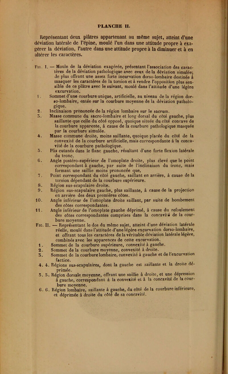 Représentant deux plâtres appartenant au même sujet, atteint d’une déviation latérale de l’épine, moulé l’un dans une attitude propre à exa- gérer la déviation, l’autre dans une attitude propre à la diminuer et à en altérer les caractères. Fig. I. — Moule de la déviation exagérée, présentant l’association des carac- tères de la déviation pathologique avec ceux de la déviation simulée; de plus offrant une assez forte incurvation dorso-lombaire destinée à masquer les caractères de la torsion et à rendre l’opposition plus sen- sible de ce plâtre avec le suivant, moulé dans l’attitude d’une légère excurvation. 1. Sommet d’une courbure unique, artificielle, au niveau de la région dor- so-lombaire, entée sur la courbure moyenne de la déviation patholo- gique. 2. Inclinaison prononcée de la région lombaire sur le sacrum. 3. Masse commune du sacro-lombaire et long dorsal du côté gauche, plus saillante que celle du côté opposé, quoique située du côté concave de la courbure apparente, à cause de la courbure pathologique masquée par la courbure simulée. 4. Masse commune droite, moins saillante, quoique placée du côté de la convexité de la courbure artificielle, mais correspondante à la conca- vité de la courbure pathologique. 5. Plis cutanés dans le flanc gauche, résultant d'une forte flexion latérale du tronc. 6. Angle postéro-supérieur de l’omoplate droite, plus élevé que le point correspondant à gauche, par suite de l’inclinaison du tronc, mais formant une saillie moins prononcée que, 7. Point correspondant du côté gauche, saillant en arrière, à cause de la torsion dépendant de la courbure supérieure. 8. Région sus-scapulaire droite. 9. Région sus-scapulaire gauche, plus saillante, à cause de la projection en arrière des deux premières côtes. 10. Angle inférieur de l’omoplate droite saillant, par suite de bombement des côtes correspondantes. 11. Angle inférieur de l’omoplate gauche déprimé, à cause du refoulement des côtes correspondantes comprises dans la concavité de la cour- bure moyenne. Fig. II. — Représentant le dos du même sujet, atteint d’une déviation latérale réelle, moulé dans l’attitude d’une légère excurvation dorso-lombaire, et offrant tous les caractères de la véritable déviation latérale légère, combinés avec les apparences de cette excurvation. 1. Sommet de la courbure supérieure, convexité à gauche. 2. Sommet de la courbure moyenne, convexité à droite. 3. Sommet de la courbure lombaire, convexité à gauche et de l’excurvation factice. . 4. 4. Régions sus-scapulaires, dont la gauche est saillante et la droite dé- primée. _ . 5.5. Région dorsale moyenne, offrant une saillie à droite, et une dépression à gauche, correspondant à la convexité et à la concavité de la cour- bure moyenne. 6.6. Région lombaire, saillante à gauche, du côté de la courbure inferieure, et déprimée à droite du côté de sa concavité.