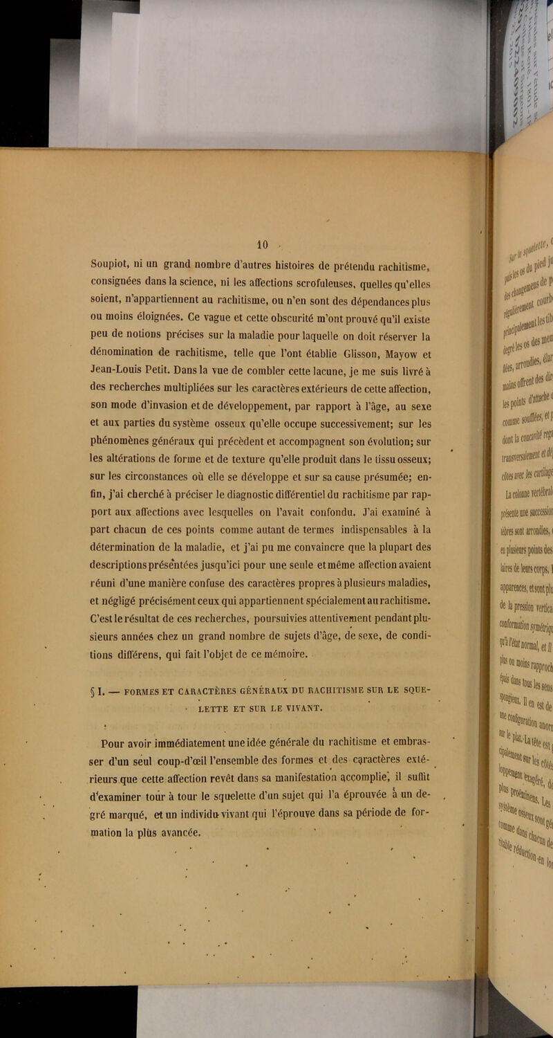 Soupiot, ni un grand nombre d'autres histoires de prétendu rachitisme, consignées dans la science, ni les affections scrofuleuses, quelles qu’elles soient, n appartiennent au rachitisme, ou n’en sont des dépendances plus ou moins éloignées. Ce vague et cette obscurité m’ont prouvé qu’il existe peu de notions précises sur la maladie pour laquelle on doit réserver la dénomination de rachitisme, telle que l’ont établie Glisson, Mayow et Jean-Louis Petit. Dans la vue de combler cette lacune, je me suis livré à des recherches multipliées sur les caractères extérieurs de cette affection, son mode d’invasion et de développement, par rapport à l’âge, au sexe et aux parties du système osseux qu’elle occupe successivement; sur les phénomènes généraux qui précèdent et accompagnent son évolution; sur les altérations de forme et de texture qu’elle produit dans le tissu osseux; sur les circonstances où elle se développe et sur sa cause présumée; en- fin, j’ai cherché à préciser le diagnostic différentiel du rachitisme par rap- port aux affections avec lesquelles on l’avait confondu. J’ai examiné à part chacun de ces points comme autant de termes indispensables à la détermination de la maladie, et j’ai pu me convaincre que la plupart des descriptions présentées jusqu’ici pour une seule et même affection avaient réuni d'une manière confuse des caractères propres à plusieurs maladies, et négligé précisément ceux qui appartiennent spécialement au rachitisme. C’est le résultat de ces recherches, poursuivies attentivement pendant plu- sieurs années chez un grand nombre de sujets d’âge, de sexe, de condi- tions différens, qui fait l’objet de ce mémoire. § I. — FORMES ET CARACTÈRES GÉNÉRAUX DU RACHITISME SUR LE SQUE- • LETTE ET SUR LE VIVANT. Pour avoir immédiatement une idée générale du rachitisme et embras- ser d’un seul coup-d’œil l’ensemble des formes et des caractères exté- rieurs que cette affection revêt dans sa manifestation accomplie, il suffit d'examiner tour à tour le squelette d’un sujet qui l’a éprouvée à un de- gré marqué, et un individu vivant qui l’éprouve dans sa période de for- mation la plus avancée.