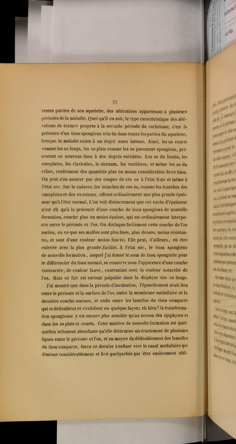 rentes parties de son squelette, des altérations appartenant à plusieurs périodes delà maladie. Quoi qu’il en soit, le type caractéristique des alté- rations de texture propres à la seconde période du rachitisme, c’est la présence d’un tissu spongieux très lin dans toutes les parties du squelette, lorsque la maladie existe à un degré assez intense. Ainsi, les os courts comme les os longs, les os plats comme les os purement spongieux, pré- sentent ce nouveau tissu à des degrés variables. Les os du bassin, les omoplates, les clavicules, le sternum, les vertèbres, et même les os du crâne, renferment des quantités plus ou moins considérables de ce tissu. On peut s’en assurer par des coupes de ces os à l’état frais et même à l’état sec. Sur le cadavre, les tranches de ces os, comme les tranches des omoplates et des os coxaux, offrent ordinairement une plus grande épais- seur qu’à l’état normal. L’on voit distinctement que cet excès d’épaisseur n’est dû qu’à la présence d’une couche de tissu spongieux de nouvelle formation, couche plus ou moins épaisse, qui est ordinairement interpo- sée entre le périoste et l’os. On distingue facilement cette couche de l’os ancien, en ce que ses mailles sont plus fines, plus denses, moins résistan- tes, et sont d’une couleur moins foncée. Elle peut, d’ailleurs, en être enlevée avec la plus grandeJfacilité. A l’état sec, le tissu spongieux de nouvelle formation , auquel j’ai donné le nom de tissu spongoïde pour le différencier du tissu normal, se conserve sous l’apparence d’une couche contractée, de couleur fauve, contrastant avec la couleur naturelle de l’os. Mais ce fait est surtout palpable dans la diaphyse des os longs. J’ai montré que dans la période d’incubation, l’épanchement avait lieu entre le périoste et la surface de l’os, entre la membrane médullaire et la dernière couche osseuse, et enfin entre les lamelles du tissu compacte qui se dédoublent et s’exfolient en quelque façon; eh bien ! la transforma- tion spongieuse y est encore plus sensible qu'au niveau des épiphyses et dans les os plats et courts. Cette matière de nouvelle formation est quel- quefois tellement abondante qu’elle détermine un écartement de plusieurs lignes entre le périoste et l’os, et au moyen du dédoublement des lamelles du tissu compacte, force ce dernier à refluer vers le canal médullaire qui diminue considérablement et finit quelquefois par être entièrement obli-
