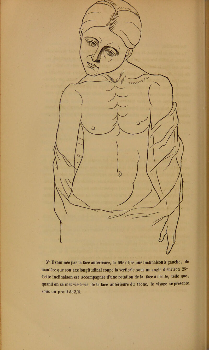 3® Examinée par la face antérieure, la tête ofire une inclinaison à gauche, de manière que son axe longitudinal coupe la verticale sous un angle d’environ 25°. Celte inclinaison est accompagnée d’une rotation de la face à droite, telle que, quand on se met vis-à-vis de la face antérieure du tronc, le visage se présente sous un profil de 3/4.