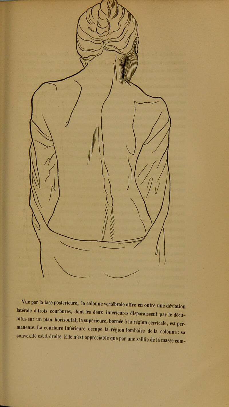 Vue par la face postérieure, la colonne vertébrale offre en outre une déviation latérale à trois courbures, dont tes deux inférieures disparaissent par le décu- bitus sur un plan horizontal; la supérieure, bornée à la région cervicale, est per- manente. La courbure inférieure occupe la région lombaire de la colonne: sa convexité est à droite. Elle n'est appréciable que par une saillie de la masse corn-