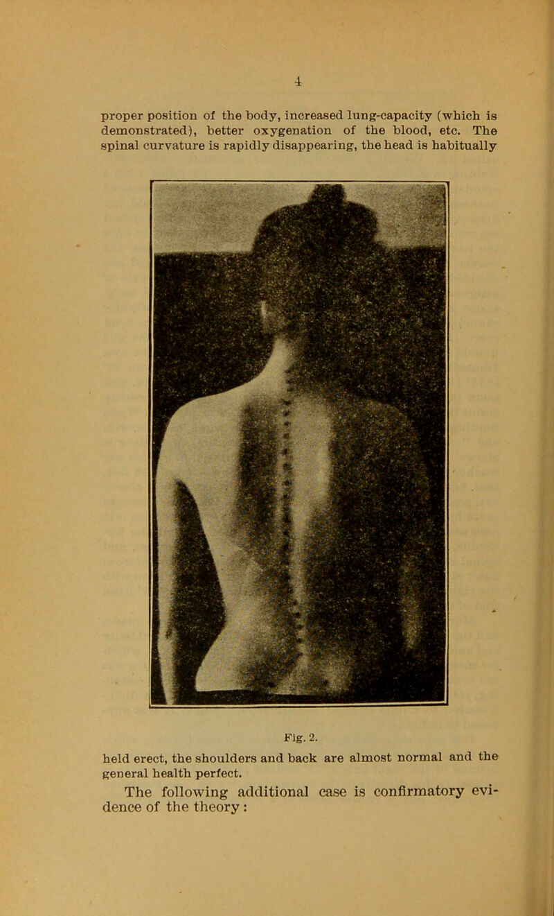 proper position of the body, increased lung-capacity (which is demonstrated), better oxygenation of the blood, etc. The spinal curvature is rapidly disappearing, the head is habitually Fig. 2. held erect, the shoulders and back are almost normal and the general health perfect. The following additional case is confirmatory evi- dence of the theory: