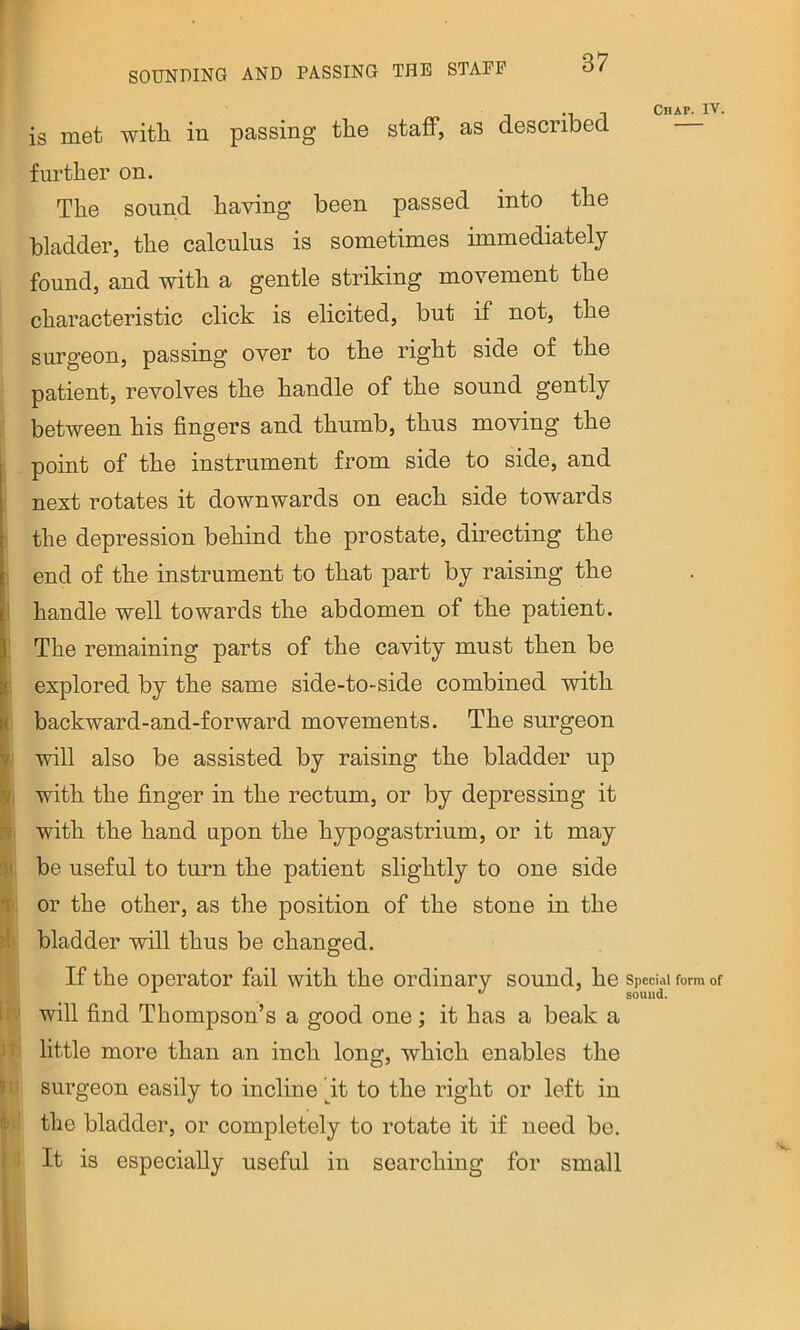 is met with in passing the staff, as described i liv it III further on. The sound having been passed into the bladder, the calculus is sometimes immediately found, and with a gentle striking movement the characteristic click is elicited, but if not, the surgeon, passing over to the right side of the patient, revolves the handle of the sound gently between his fingers and thumb, thus moving the point of the instrument from side to side, and next rotates it downwards on each side towards the depression behind the prostate, directing the end of the instrument to that part by raising the handle well towards the abdomen of the patient. The remaining parts of the cavity must then be explored by the same side-to-side combined with backward-and-forward movements. The surgeon will also be assisted by raising the bladder up with the finger in the rectum, or by depressing it with the hand upon the hypogastrium, or it may be useful to turn the patient slightly to one side or the other, as the position of the stone in the bladder will thus be changed. If the operator fail with the ordinary sound, he will find Thompson’s a good one; it has a beak a little more than an inch long, which enables the surgeon easily to incline fit to the right or left in the bladder, or completely to rotate it if need bo. It is especially useful in searching for small