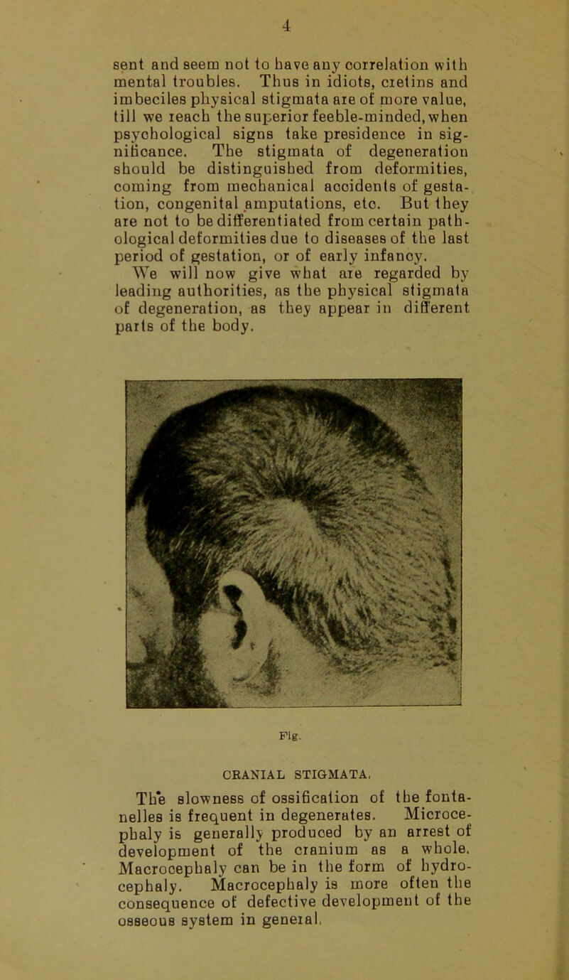 sent and seem not to have any correlation with mental troubles. Thus in idiots, cretins and imbeciles physical stigmata are of more value, till we reach the superior feeble-minded, when psychological signs take presidence in sig- nificance. The stigmata of degeneration should be distinguished from deformities, coming from meohanical accidents of gesta- tion, congenital amputations, eto. But they are not to be differentiated from certain pmth- ological deformities due to diseases of the last period of gestation, or of early infanoy. We will now give what are regarded by leading authorities, as the physical stigmata of degeneration, as they appear in different parts of the body. pig. CRANIAL STIGMATA, Tk*e slowness of ossification of the fonta- nelles is frequent in degenerates. Microce- phaly is generally produced by an arrest of development of the cranium as a whole. Macrocephaly can be in the form of hydro- cephaly. Macrocephaly is more often the consequence of defective development of the osseous system in general,