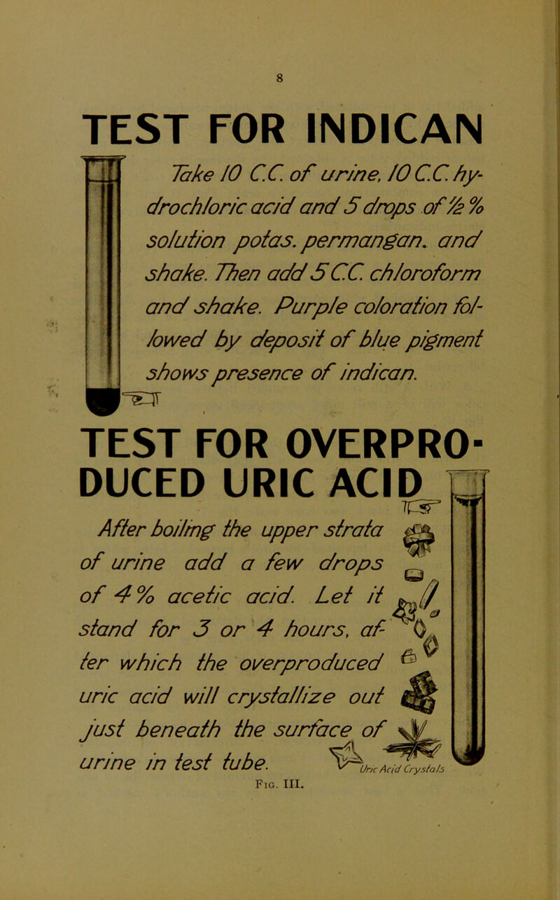 TEST FOR IN DICAN _ , lake JO C,C. of ur/ne, JO C.C hy- drochloric acid and 5 drops of fa % solution potas. permangan. and i j shake. Then add 5 CC chloroform and shake. Purple coloration fol- lowed by deposit of blue pigment I shows presence of indican. TEST FOR OVERPRO DUCED URIC ACID Q After boiling the upper strata of urine add a few drops ^ of 4% acetic acid. Let stand for 3 or ^4 hours, af' O,. ter which the overproduced ^ uric acid will crystallize out Just beneath the surface^ of urine in test tube. Uric Acid Crysfah Fig. III.