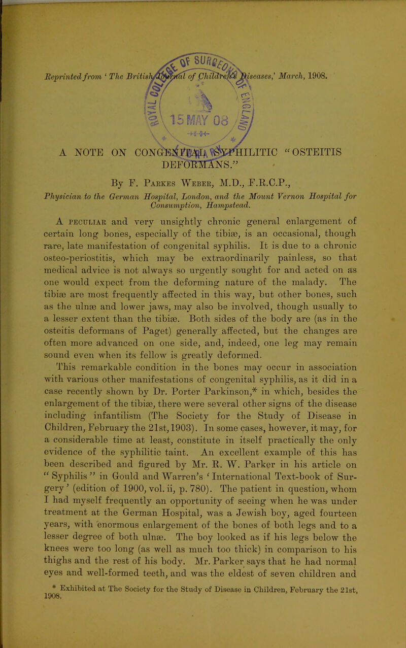 By F. Parkes Weber, M.D., F.R.C.P., Physician to the German Hospital, London, and the Mount Vernon Hospital for Consumption, Hampstead. A peculiar and very unsightly chronic general enlargement of certain long bones, especially of the tibiae, is an occasional, though rare, late manifestation of congenital syphilis. It is due to a chronic osteo-periostitis, which may be extraordinarily painless, so that medical advice is not always so urgently sought for and acted on as one would expect from the deforming nature of the malady. The tibim are most frequently affected in this way, but other bones, such, as the ulnm and lower jaws, may also be involved, though usually to a lesser extent than the tibiae. Both sides of the body are (as in the osteitis deformans of Paget) generally affected, but the changes are often more advanced on one side, and, indeed, one leg may remain sound even when its fellow is greatly deformed. This remarkable condition in the bones may occur in association with various other manifestations of congenital syphilis, as it did in a case recently shown by Dr. Porter Parkinson,* in which, besides the enlargement of the tibiae, there were several other signs of the disease including infantilism (The Society for the Study of Disease in Children, Februai’y the 21st, 1903). In some cases, however, it may, for a considerable time at least, constitute in itself practically the only evidence of the syphilitic taint. An excellent example of this has been described and figured by Mr. R. W. Parker in his article on “ Syphilis ” in Gould and Warren’s ‘ International Text-book of Sur- gery ’ (edition of 1900, vol. ii, p. 780). The patient in question, whom I had myself frequently an opportunity of seeing when he was under treatment at the German Hospital, was a Jewish boy, aged fourteen years, with enormous enlargement of the bones of both legs and to a lesser degree of both ulme. The boy looked as if his legs below the knees were too long (as well as much too thick) in comparison to his thighs and the rest of his body. Mr. Parker says that he had normal eyes and well-formed teeth, and was the eldest of seven children and * Exhibited at The Society for the Study of Disease iu Children, February the 21st,