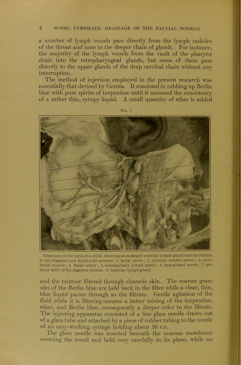a number of lymph vessels pass directly from the lymph radicles of the throat and nose to the deeper chain of glands. For instance, the majority of the lymph vessels from the vault of the pharynx drain into the retropharyngeal glands, but some of them pass directly to the upper glands of the deep cervical chain without any interruption. The method of injection employed in the present research was essentially that devised by Gerota. It consisted in rubbing up Berlin blue with pure spirits of turpentine until it assumed the consistency of a rather thin, syrupy liquid. A small quantity of ether is added Fig. 1 Dissection of the neck of a child, showing an enlarged tonsillar lymph gland and its relation to the digastric and stylohyoid muscles: 1, facial nerve ; 2, external carotid artery ; 3, stylo- hyoid muscle ; 4, facial artery ; 5, submaxillary lymph gland ; 6, hypoglossal nerve; 7, pos- terior belly of the digastric muscle; 8, tonsillar lymph gland. and the mixture filtered through chamois skin. The coarser gran- ules of the Berlin blue are held back in the filter while a clear, thin, blue liquid passes through as the filtrate. Gentle agitation of the fluid while it is filtering ensures a better mixing of the turpentine, ether, and Berlin blue, consequently a deeper color to the filtrate. The injecting apparatus consisted of a fine glass needle drawn out of a glass tube and attached by a piece of rubber tubing to the nozzle of an easy-working syringe holding about 10 c.c. The glass needle was inseited beneath the mucous membrane covering the tonsil and held very carefully in its place, while an