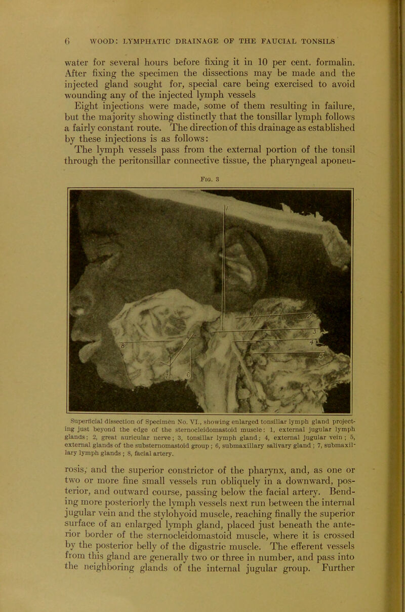 water for several hours before fixing it in 10 per cent, formalin. After fixing the specimen the dissections may be made and the injected gland sought for, special care being exercised to avoid wounding any of the injected lymph vessels Eight injections were made, some of them resulting in failure, but the majority showing distinctly that the tonsillar lymph follows a fairly constant route. The direction of this drainage as established by these injections is as follows: The lymph vessels pass from the external portion of the tonsil through the peritonsillar connective tissue, the pharyngeal aponeu- Fig. 3 Superficial dissection of Specimen No. VI., showing enlarged tonsillar lymph gland project- ing just beyond the edge of the sternocleidomastoid muscle: 1, external jugular lymph glands; 2, great auricular nerve; 3, tonsillar lymph gland; 4, external jugular vein ; 5, external glands of the substernomastoid group ; G, submaxillary salivary gland ; 7, submaxil lary lymph glands ; 8, facial artery. rosis; and the superior constrictor of the pharynx, and, as one or two or more fine small vessels run obliquely in a downward, pos- terior, and outward course, passing below the facial artery. Bend- ing more posteriorly the lymph vessels next run between the internal jugular vein and the stylohyoid muscle, reaching finally the superior surface of an enlarged lymph gland, placed just beneath the ante- rior border of the sternocleidomastoid muscle, where it is crossed by the posterior belly of the digastric muscle. The efferent vessels from this gland are generally two or three in number, and pass into the neighboring glands of the internal jugular group. Further