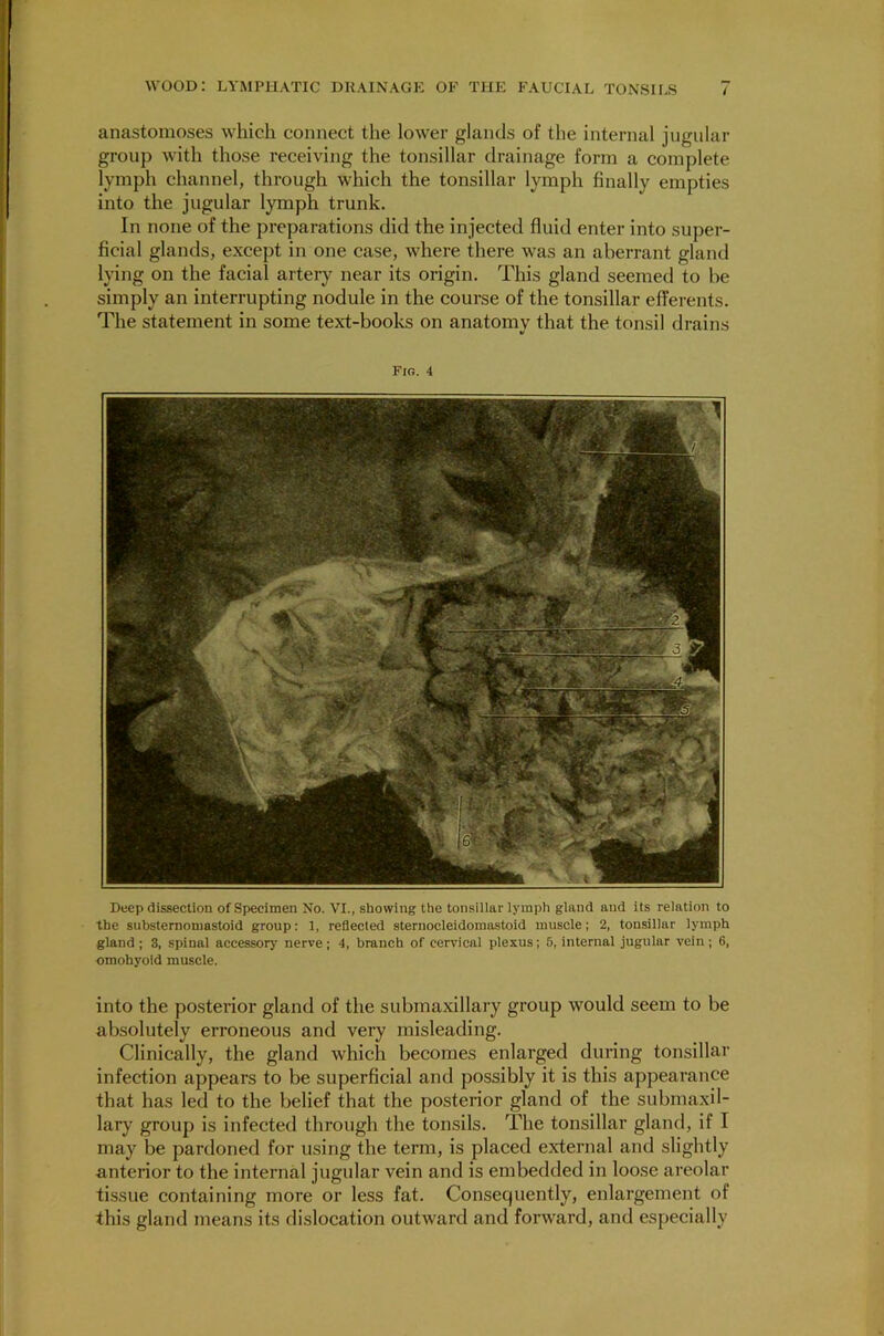 anastomoses which connect the lower glands of the internal jugular group with those receiving the tonsillar drainage form a complete lymph channel, through which the tonsillar lymph finally empties into the jugular lymph trunk. In none of the preparations did the injected fluid enter into super- ficial glands, except in one case, where there was an aberrant gland lying on the facial artery near its origin. This gland seemed to be simply an interrupting nodule in the course of the tonsillar efferents. The statement in some text-books on anatomy that the tonsil drains Fig. 4 Deep dissection of Specimen No. VI., showing the tonsillar lymph gland and its relation to the substernomastoid group: 1, reflected sternocleidomastoid muscle; 2, tonsillar lymph gland; 3, spinal accessory nerve; 4, branch of cervical plexus; 5, internal jugular vein; 6, omohyoid muscle. into the posterior gland of the submaxillary group would seem to be absolutely erroneous and very misleading. Clinically, the gland which becomes enlarged during tonsillar infection appears to be superficial and possibly it is this appearance that has led to the belief that the posterior gland of the submaxil- lary group is infected through the tonsils. The tonsillar gland, if I may be pardoned for using the term, is placed external and slightly anterior to the internal jugular vein and is embedded in loose areolar tissue containing more or less fat. Consequently, enlargement of this gland means its dislocation outward and forward, and especially