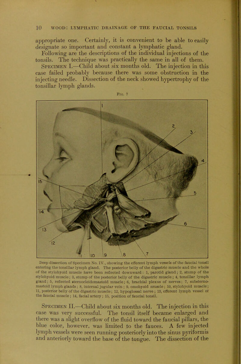 appropriate one. Certainly, it is convenient to be able to easily designate so important and constant a lymphatic gland. Following are the descriptions of the individual injections of the tonsils. The technique was practically the same in all of them. Specimen I.—Child about six months old. The injection in this case failed probably because there was some obstruction in the injecting needle. Dissection of the neck showed hypertrophy of the tonsillar lymph glands. Fig. 7 Deep dissection of Specimen No. IV., showing the efferent lymph vessels of the faucial tonsil entering the tonsillar lymph gland. The posterior belly of the digastric muscle and the whole of the stylohyoid muscle have been reflected downward : 1, parotid gland; 2, stump of the stylohyoid muscle; 3, stump of the posterior belly of the digastric muscle ; 4, tonsillar lymph gland; 5, reflected sternocleidomastoid muscle; 6, brachial plexus of nerves; 7, substerno- mastoid lymph glands; 8, internal jugular vein ; 9. omohyoid muscle ; 10, stylohyoid muscle; 11, posterior belly of the digastric muscle; 12, hypoglossal nerve ; 13, efferent lymph vessel ot the faucial muscle ; 14, facial artery ; 15, position of faucial tonsil. Specimen II.—Child about six months old. The injection in this case was very successful. The tonsil itself became enlarged and there was a slight overflow of the fluid toward the faucial pillars, the blue color, however, was limited to the fauces. A few injected lymph vessels were seen running posteriorly into the sinus pyriformis and anteriorly toward the base of the tongue. The dissection of the