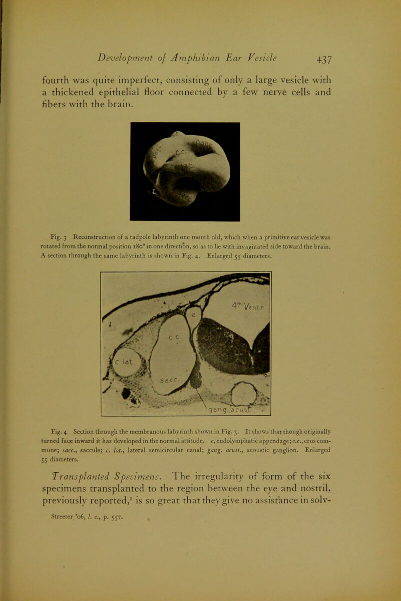 fourth was quite imperfect, consisting of only a large vesicle with a thickened epithelial floor connected by a few nerve cells and fibers with the brain. Fig. 3 Reconstruction of a tadpole labyrinth one month old, which when a primitive ear vesicle was rotated from the normal position i8o° in one direction, so as to lie with invaginated side toward the brain. A section through the same labyrinth is shown in Fig. 4. Enlarged 55 diameters. Fig. 4 Section through the membranous labyrinth shown in Fig. 3. It shows that though originally turned face inward it has developed in the normal attitude, e, endolymphatic appendage; c.c., crus com- mune; sacc., saccule; c. lat., lateral semicircular canal; gang, acust., acoustic ganglion. Enlarged 55 diameters. Transplanted Specimens. The irregularity of form of the six specimens transplanted to the region between the eye and nostril, previously reported,is so great that they give no assistance in solv- Streeter ’06, 1. c., p. 557.